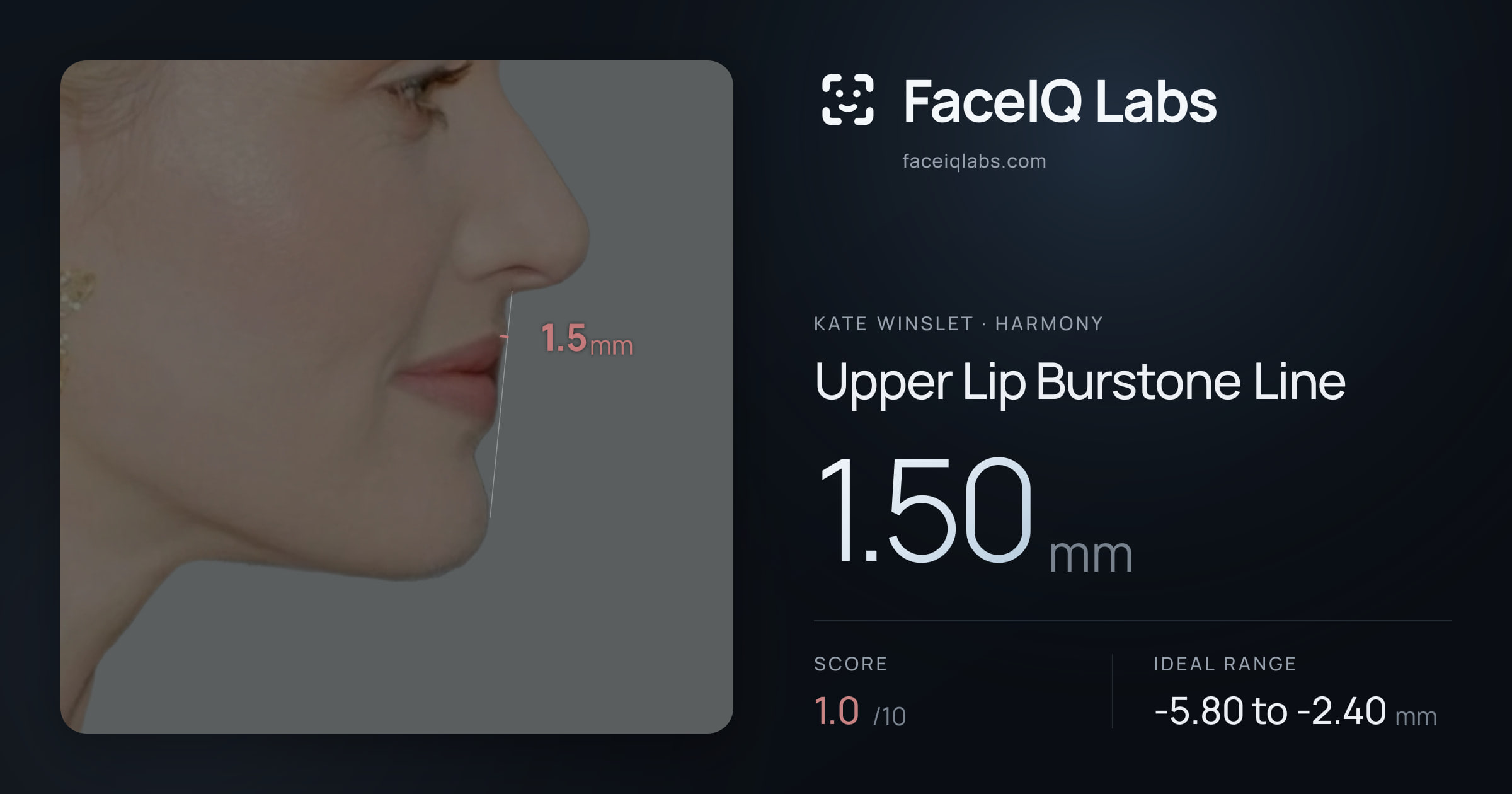 Kate Winslet Upper Lip Burstone Line: 1.50mm, drawn on the photo