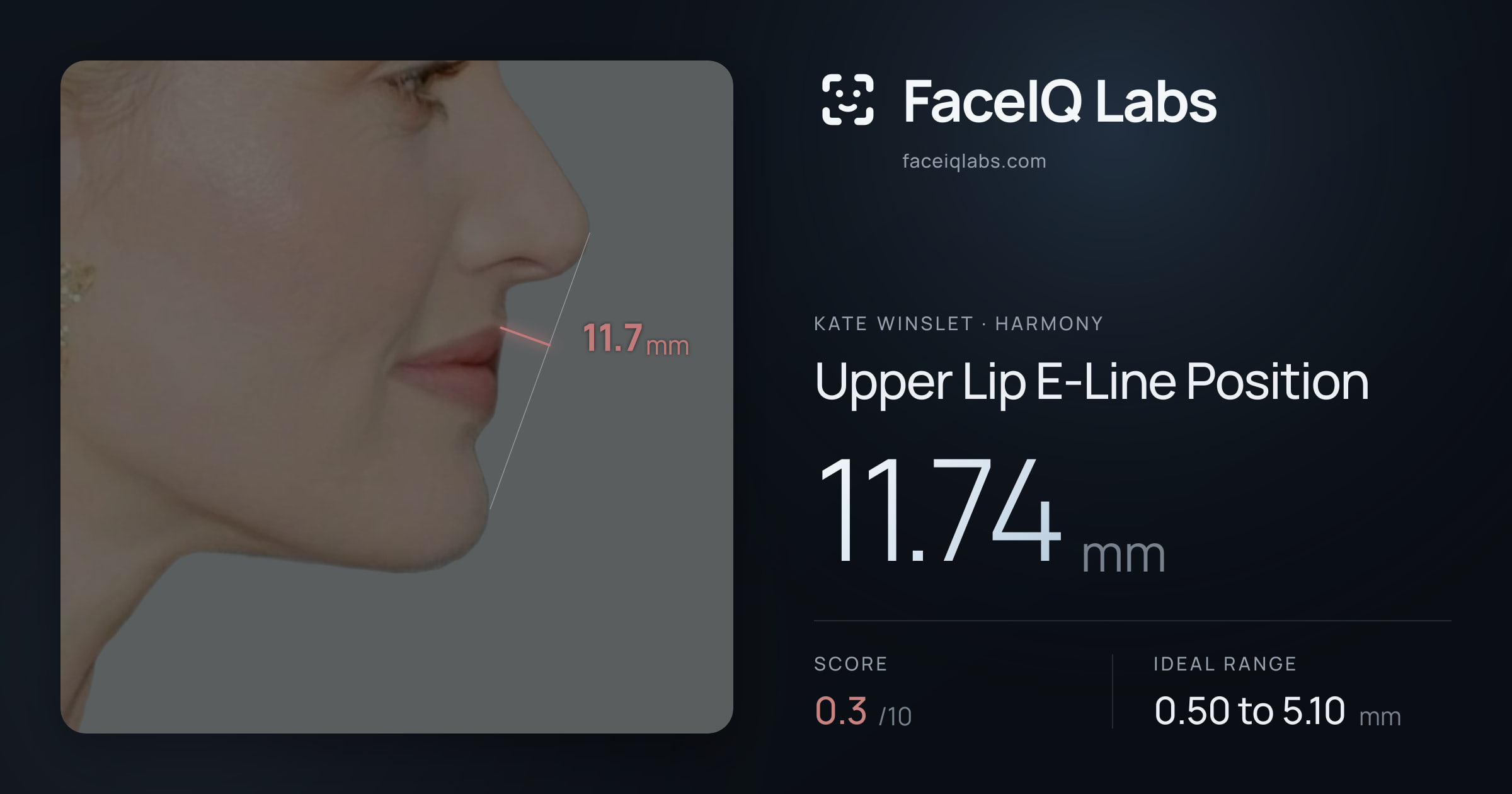 Kate Winslet Upper Lip E-Line Position: 11.74mm, drawn on the photo