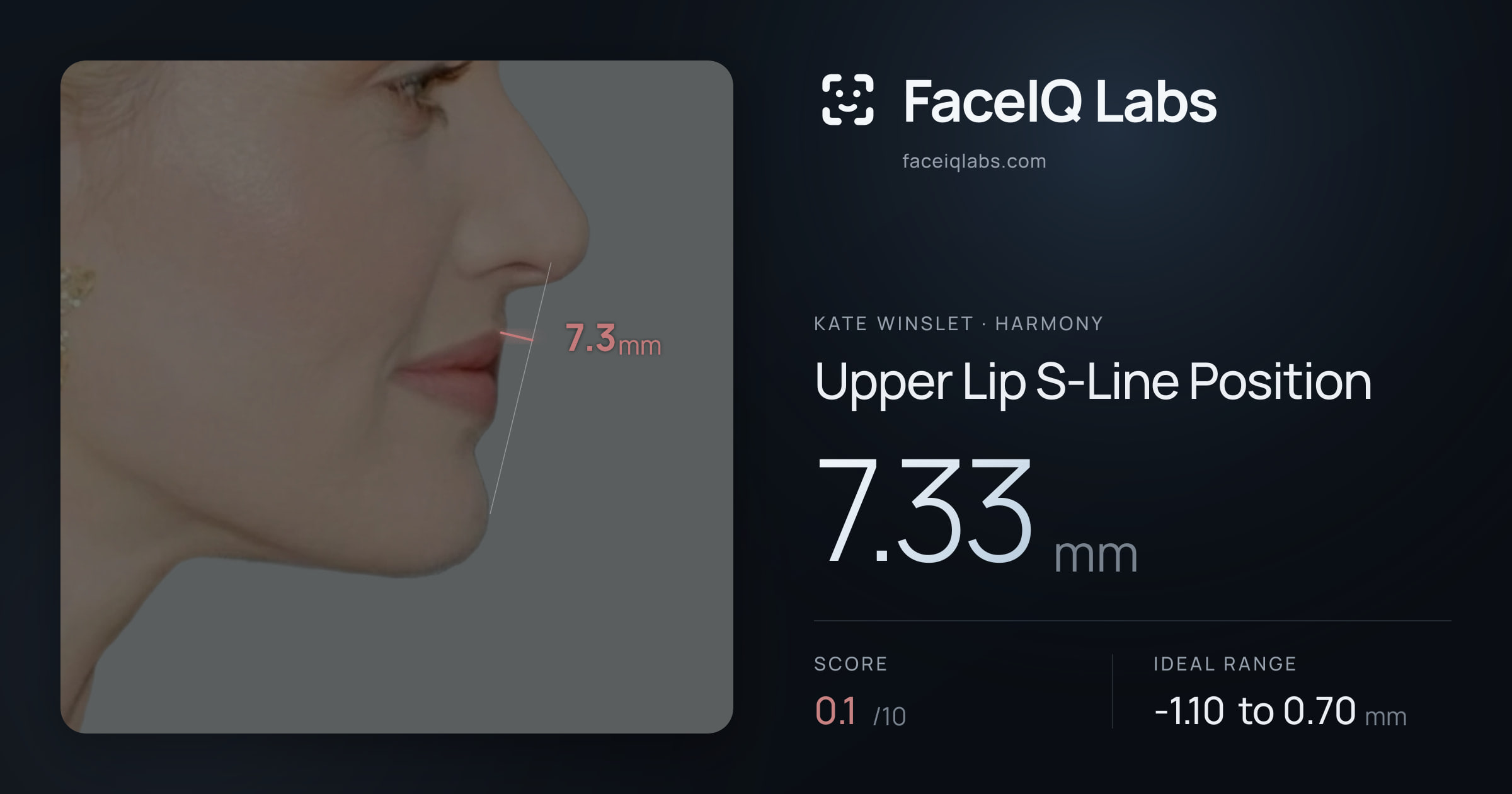 Kate Winslet Upper Lip S-Line Position: 7.33mm, drawn on the photo