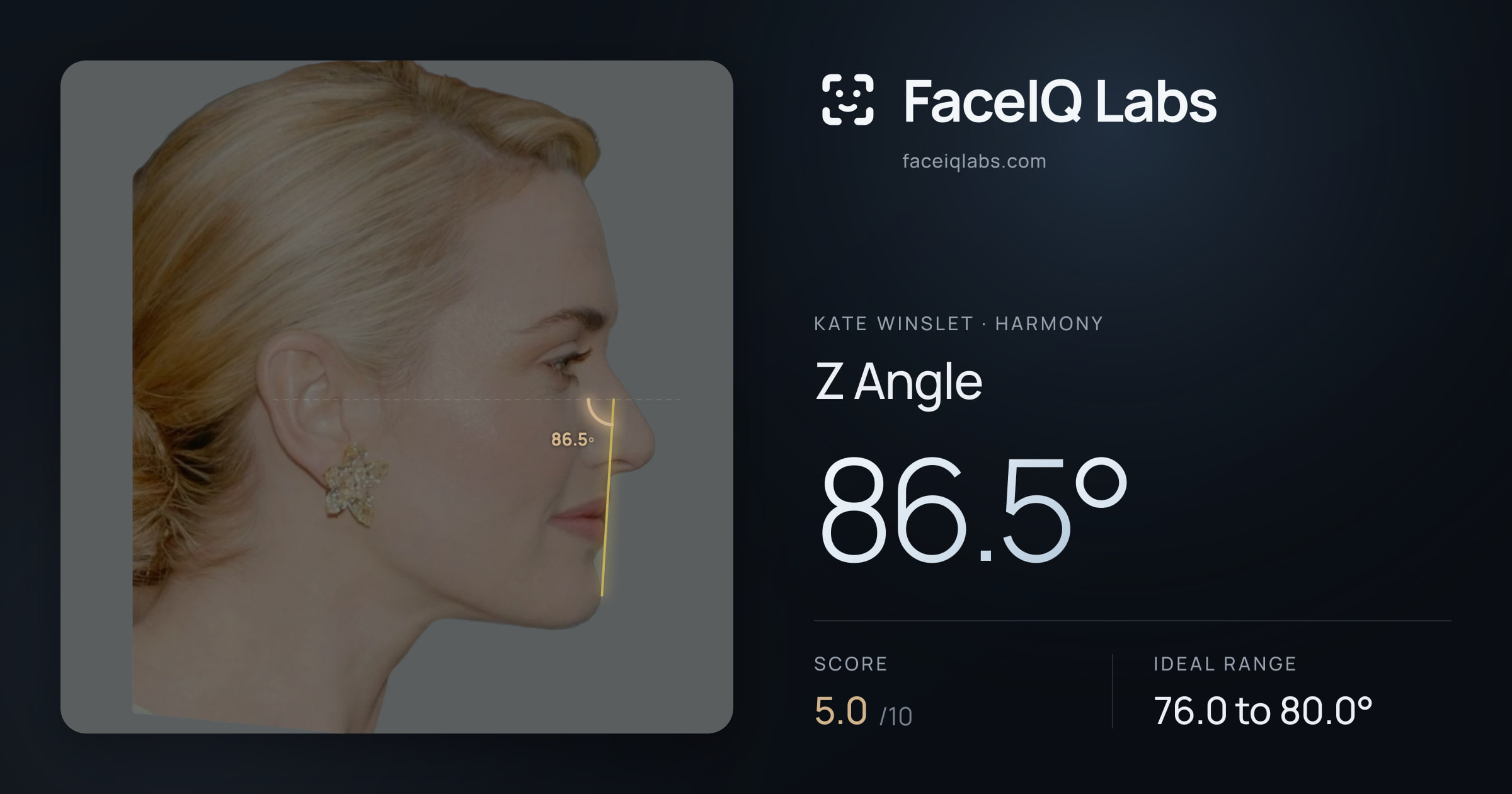 Kate Winslet Z Angle: 86.5°, drawn on the photo