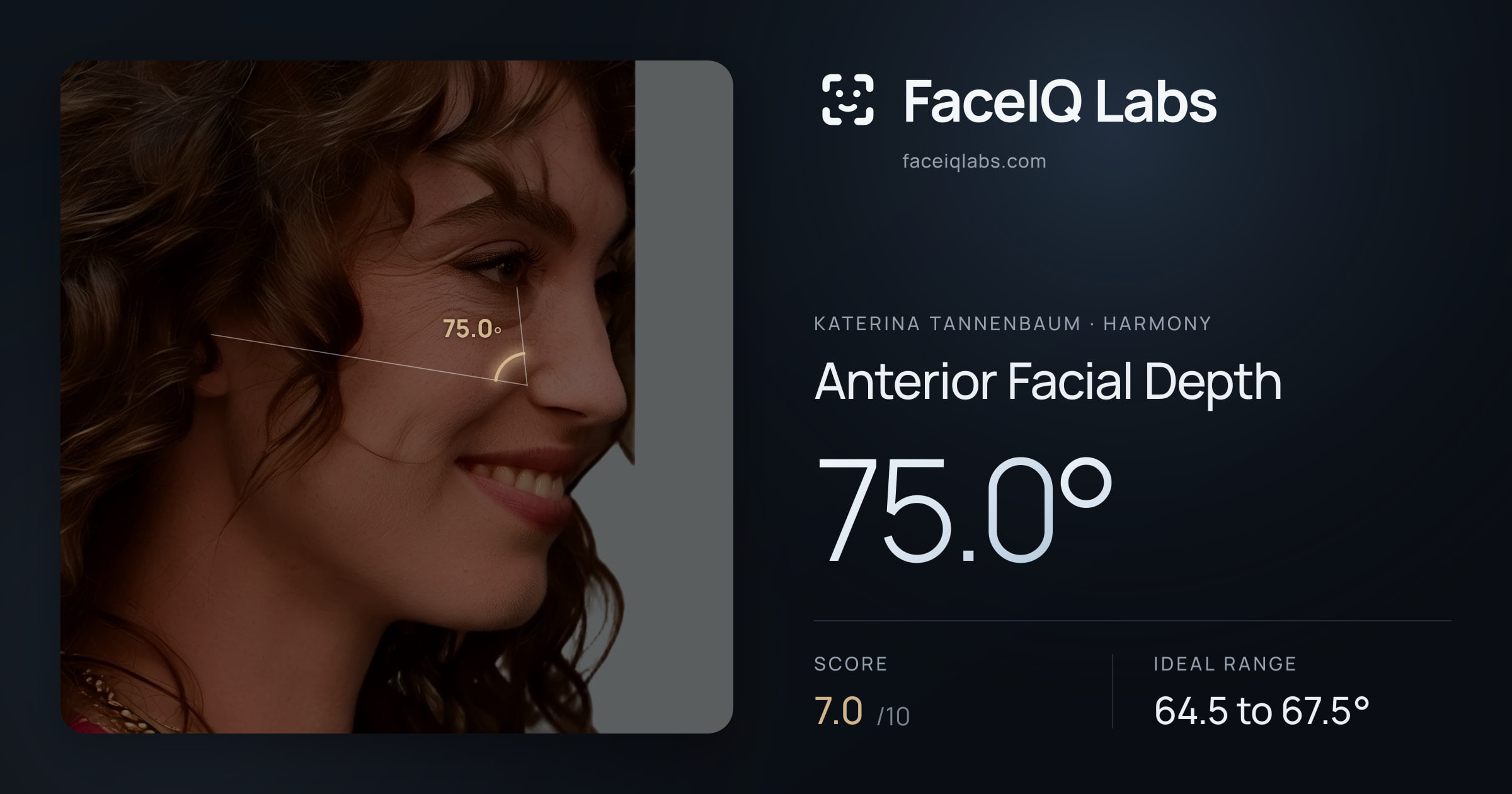Katerina Tannenbaum Anterior Facial Depth: 75.0°, drawn on the photo