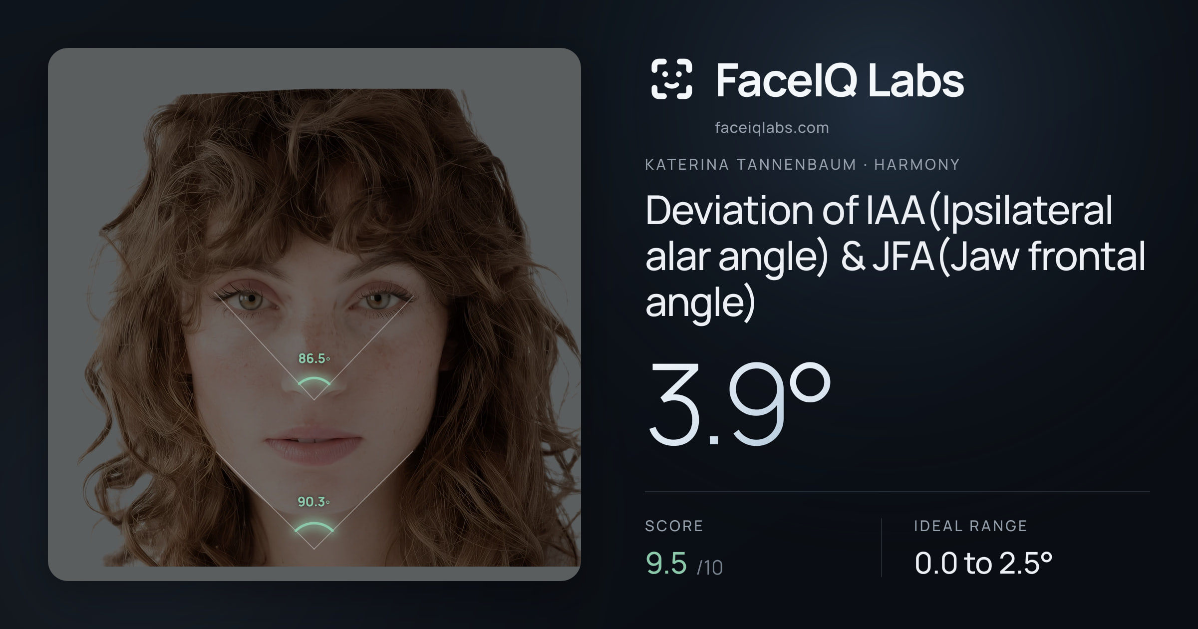 Katerina Tannenbaum Deviation of IAA(Ipsilateral alar angle) & JFA(Jaw frontal angle): 3.9°, drawn on the photo