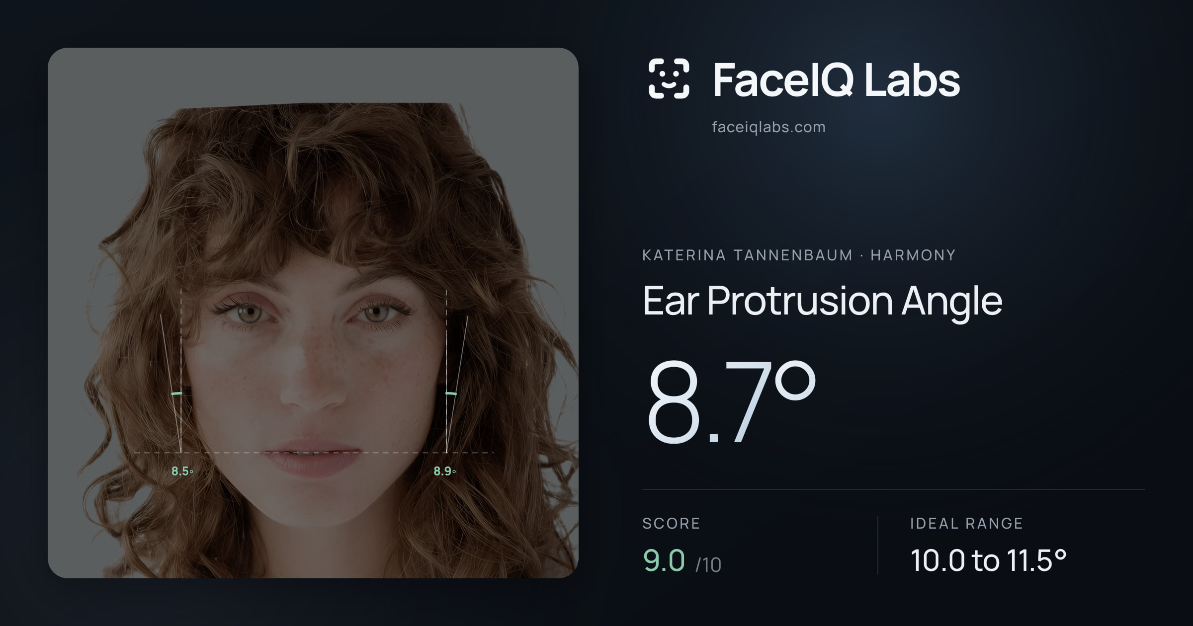 Katerina Tannenbaum Ear Protrusion Angle: 8.7°, drawn on the photo