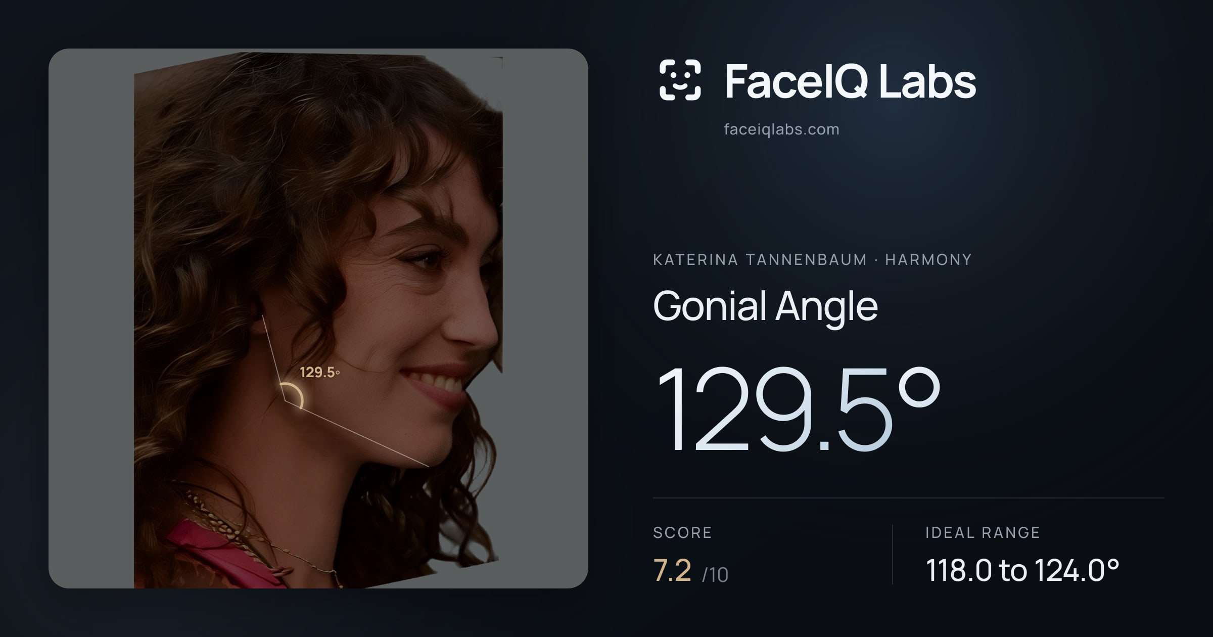 Katerina Tannenbaum Gonial Angle: 129.5°, drawn on the photo