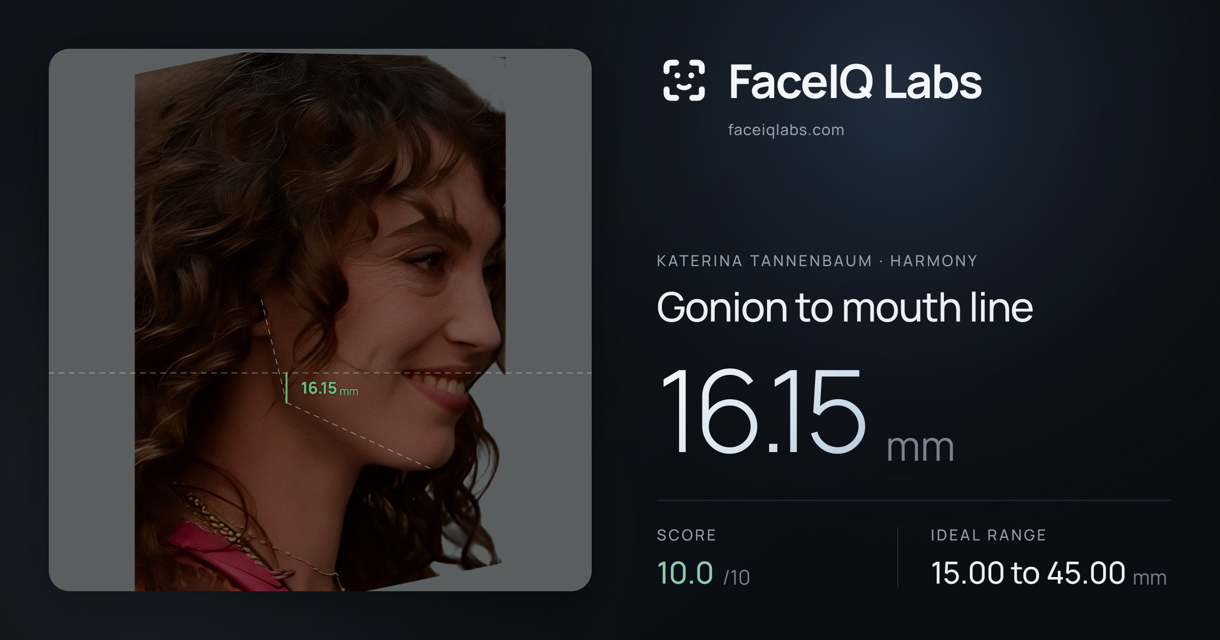 Katerina Tannenbaum Gonion to mouth line: 16.15mm, drawn on the photo