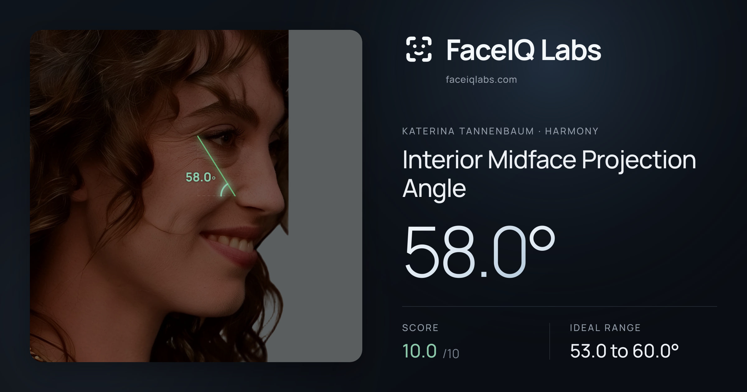 Katerina Tannenbaum Interior Midface Projection Angle: 58.0°, drawn on the photo