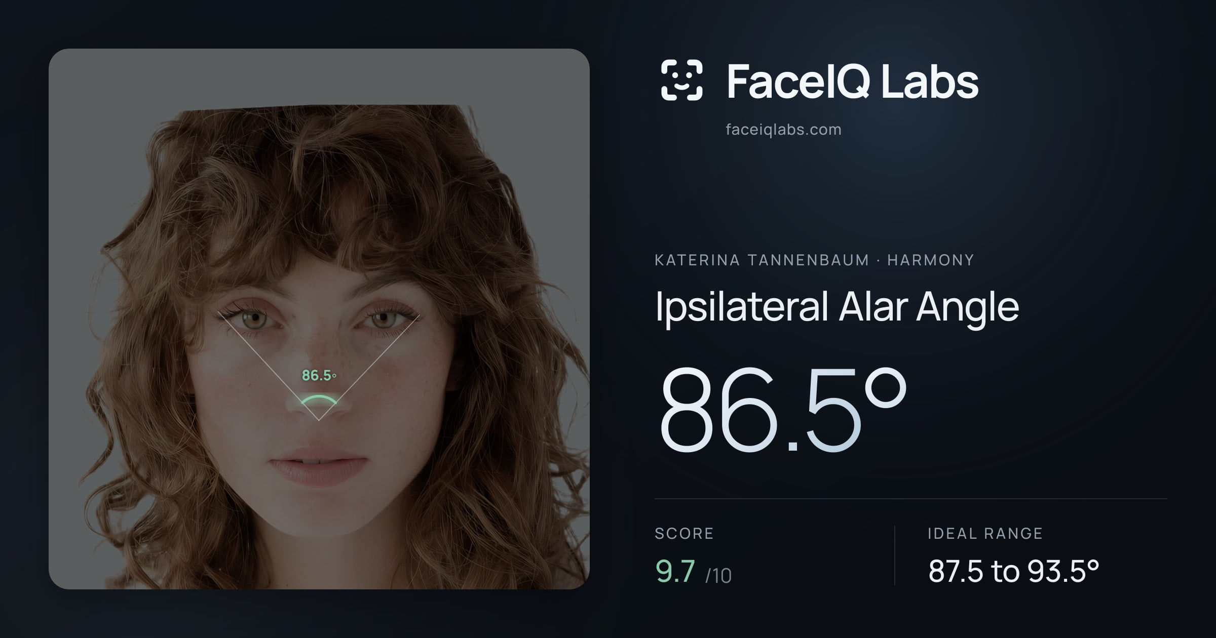 Katerina Tannenbaum Ipsilateral Alar Angle: 86.5°, drawn on the photo