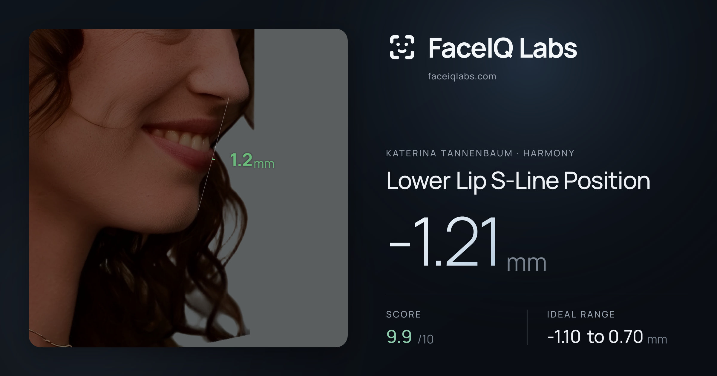 Katerina Tannenbaum Lower Lip S-Line Position: -1.21mm, drawn on the photo