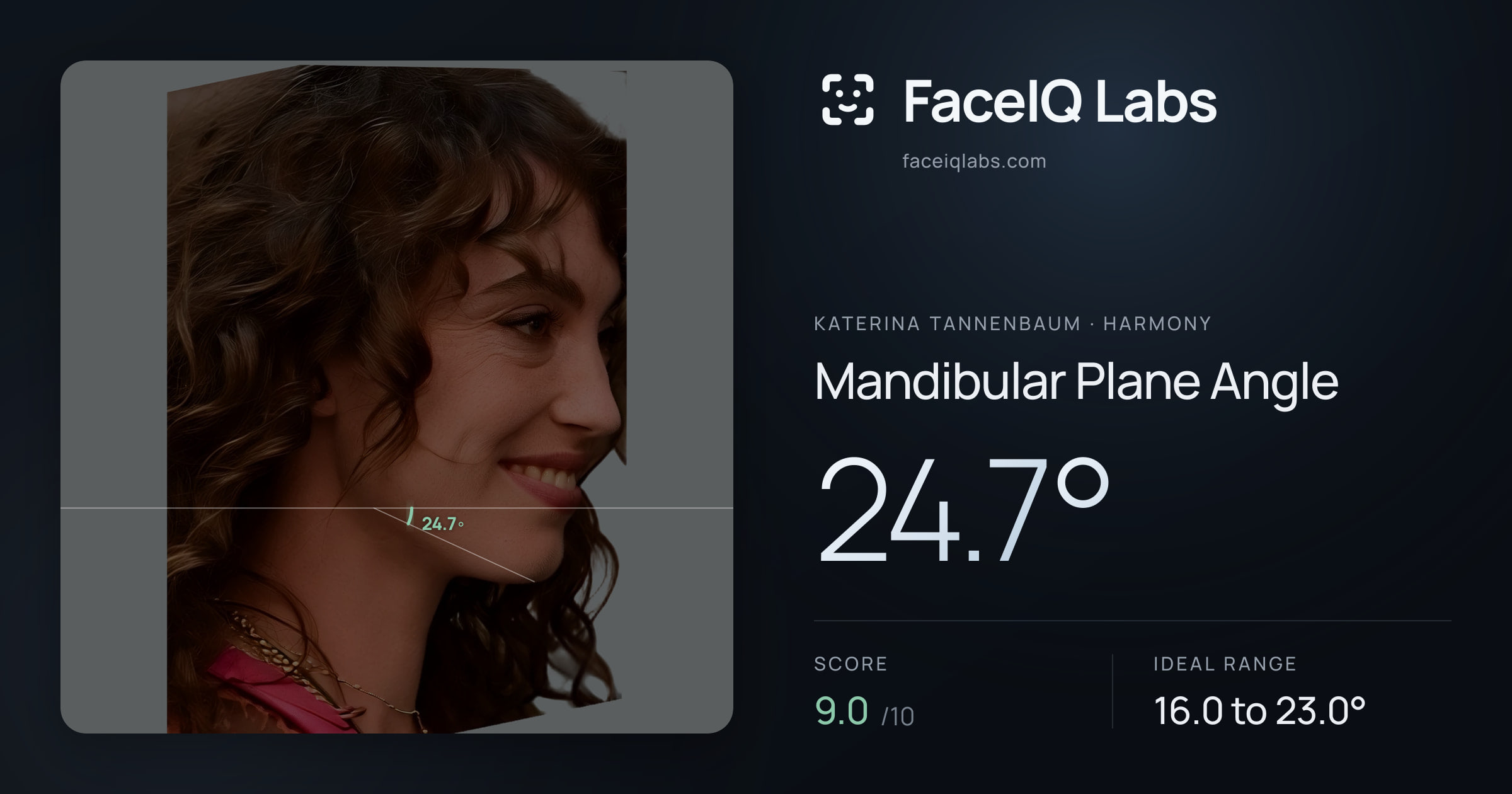 Katerina Tannenbaum Mandibular Plane Angle: 24.7°, drawn on the photo