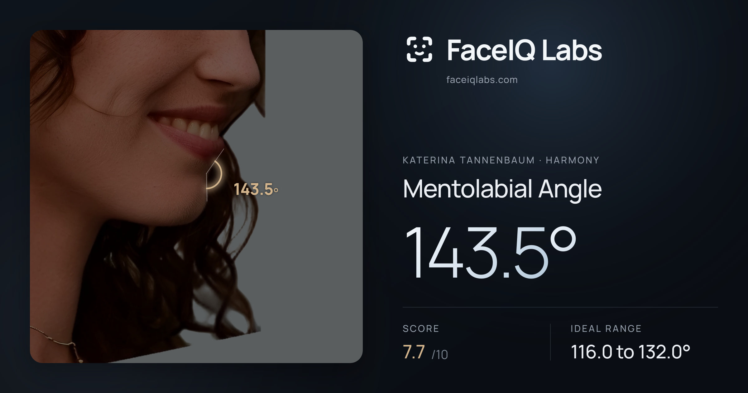 Katerina Tannenbaum Mentolabial Angle: 143.5°, drawn on the photo