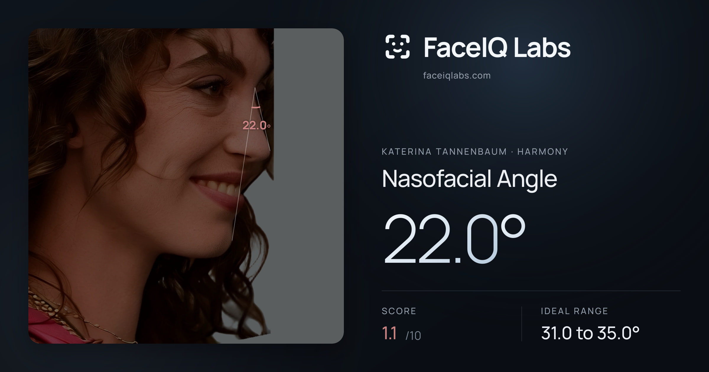 Katerina Tannenbaum Nasofacial Angle: 22.0°, drawn on the photo