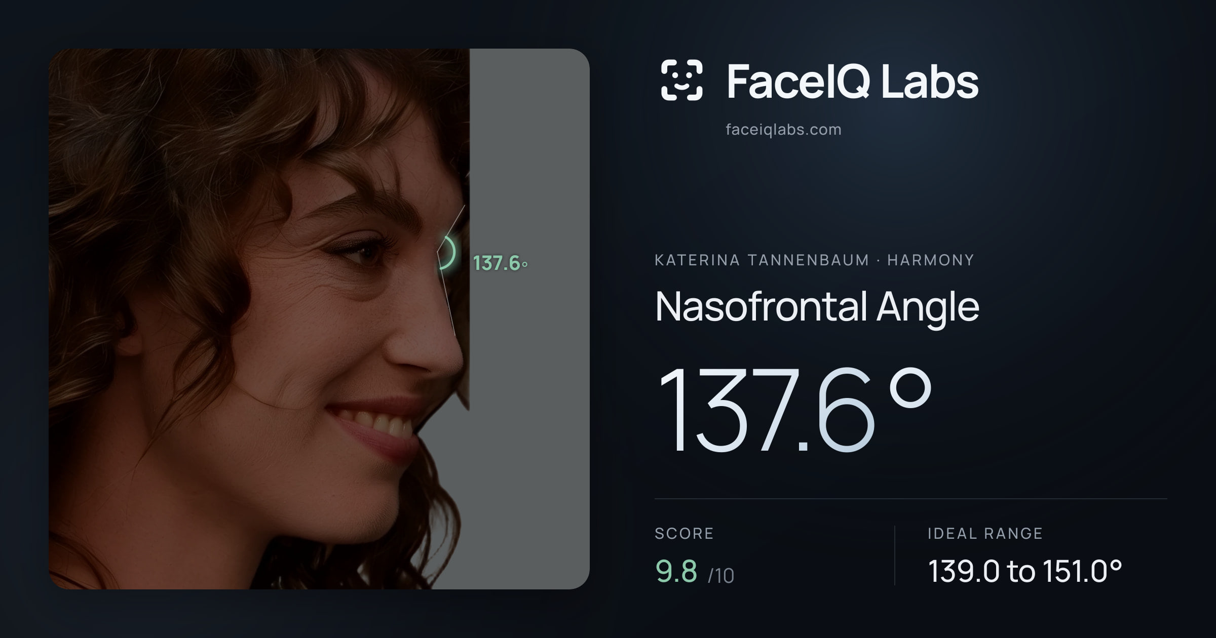 Katerina Tannenbaum Nasofrontal Angle: 137.6°, drawn on the photo
