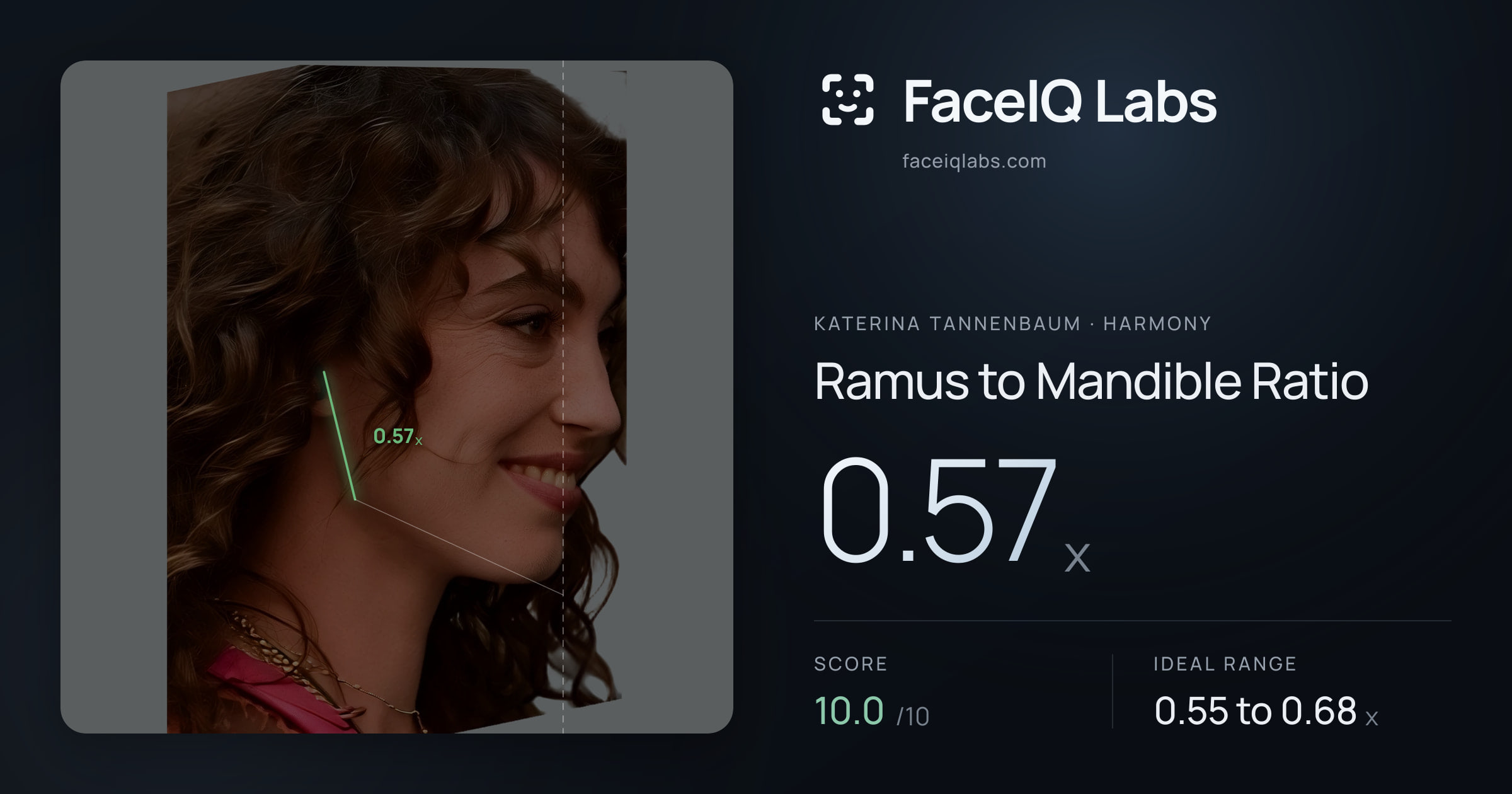 Katerina Tannenbaum Ramus to Mandible Ratio: 0.57x, drawn on the photo