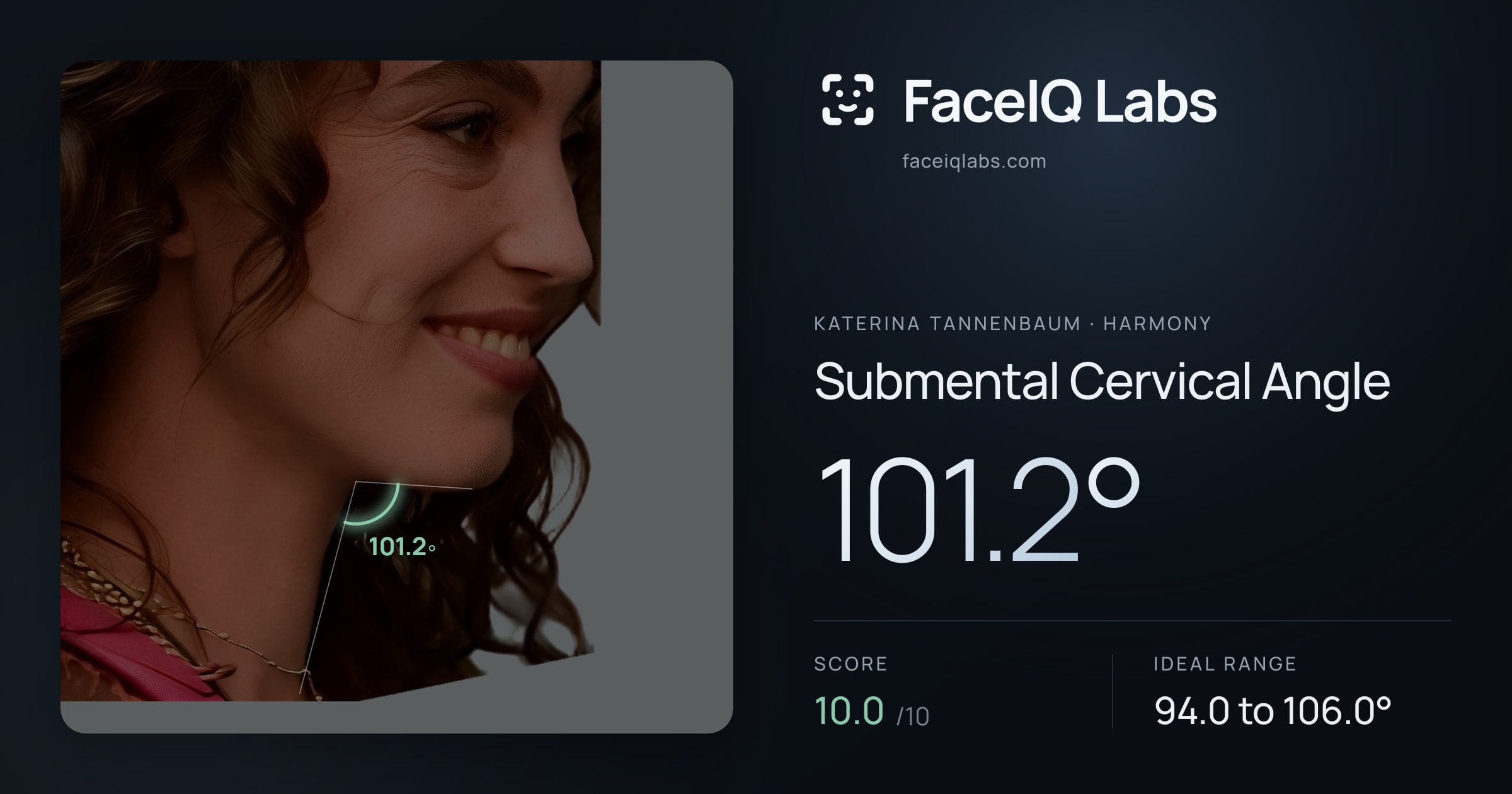 Katerina Tannenbaum Submental Cervical Angle: 101.2°, drawn on the photo