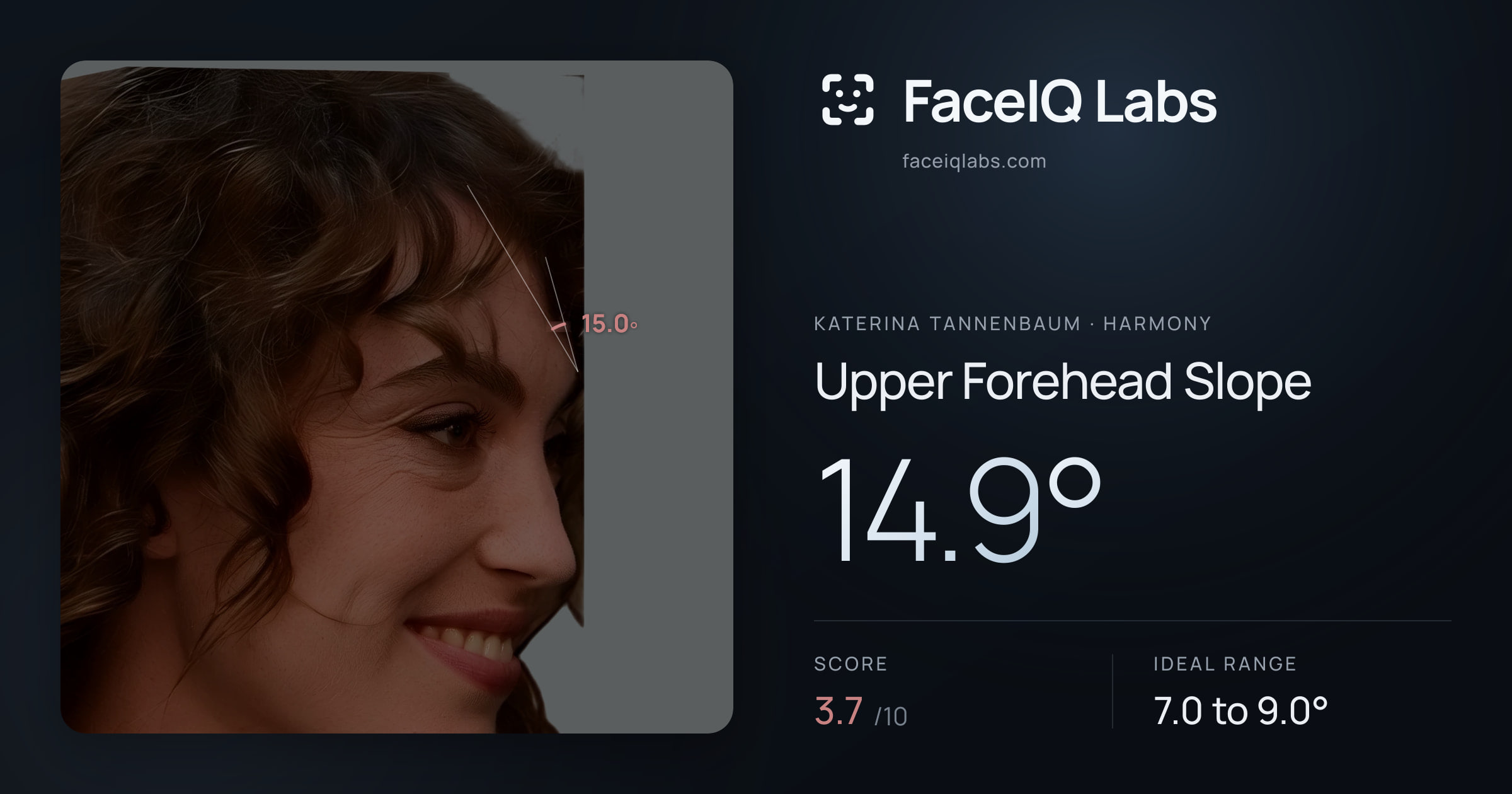 Katerina Tannenbaum Upper Forehead Slope: 14.9°, drawn on the photo