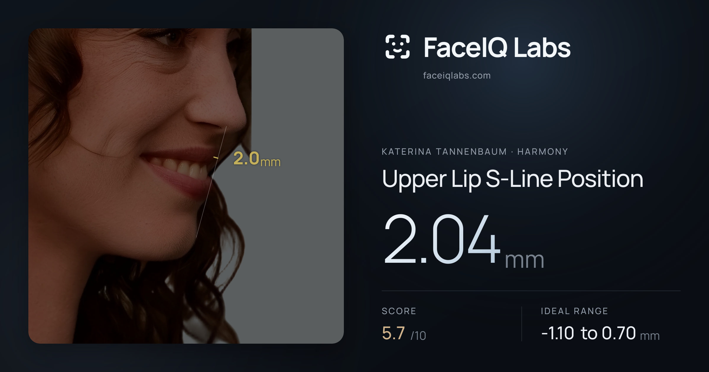 Katerina Tannenbaum Upper Lip S-Line Position: 2.04mm, drawn on the photo