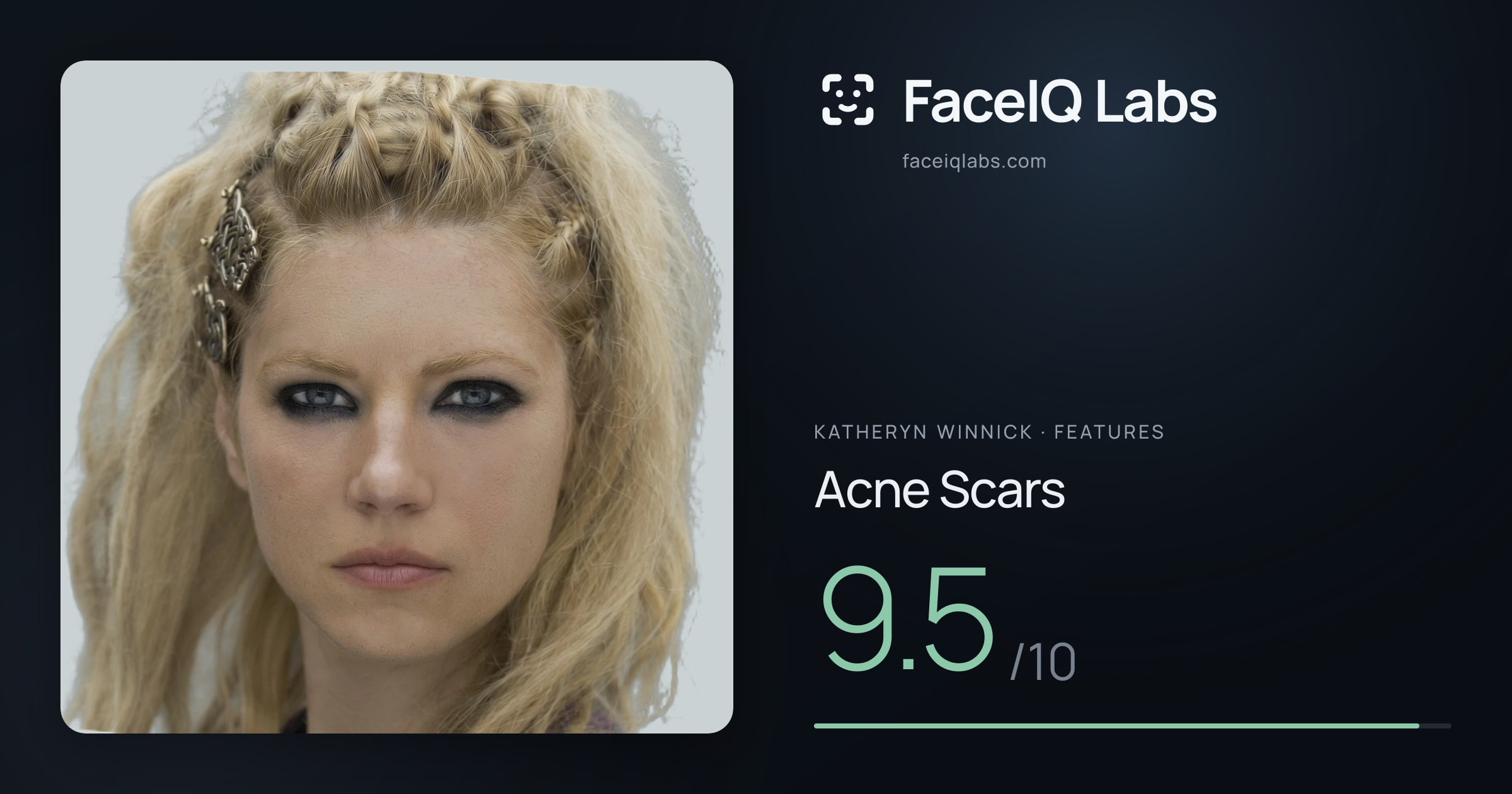 Katheryn Winnick Acne Scars: 9.5/10, drawn on the photo