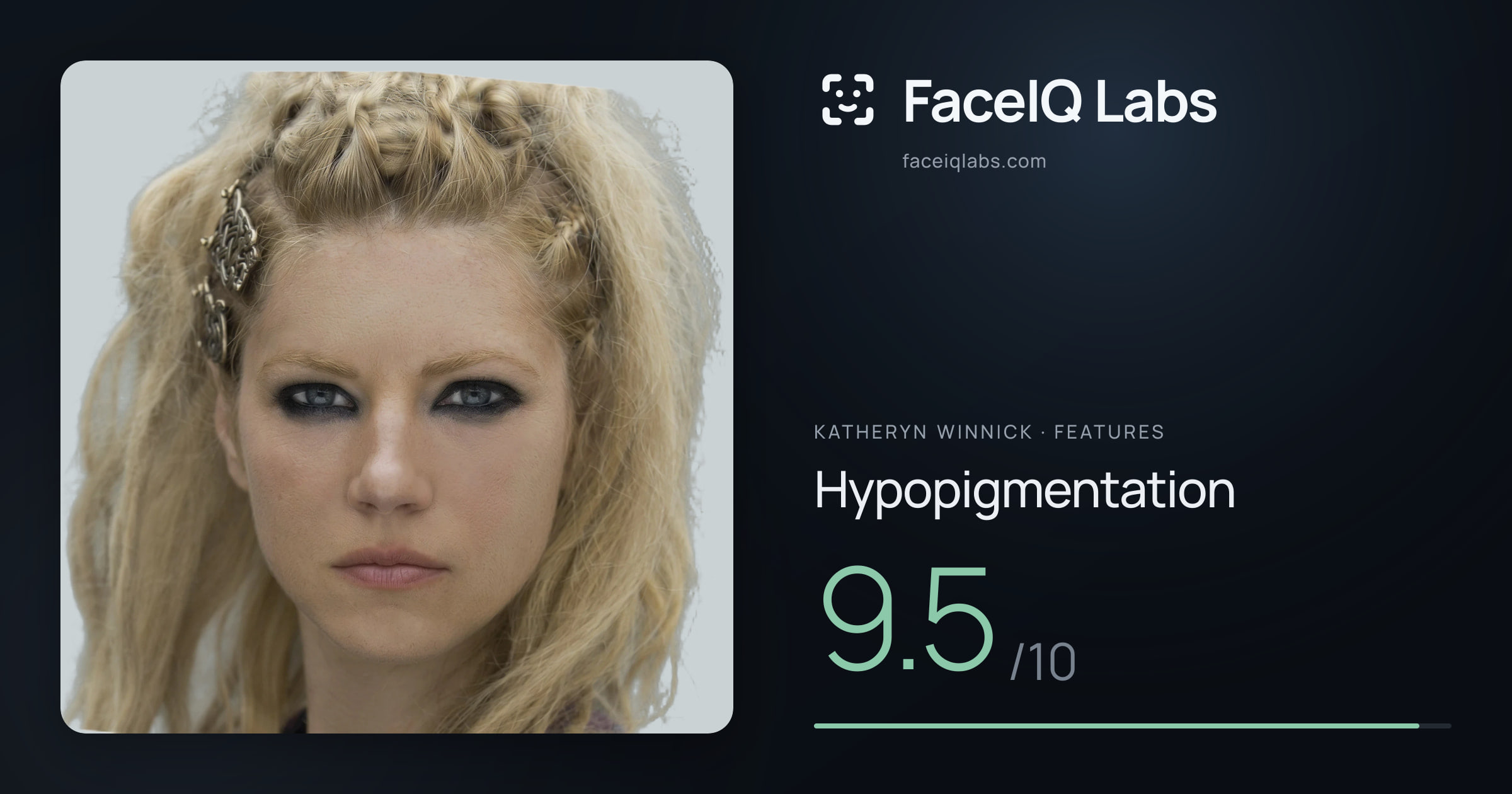 Katheryn Winnick Hypopigmentation: 9.5/10, drawn on the photo