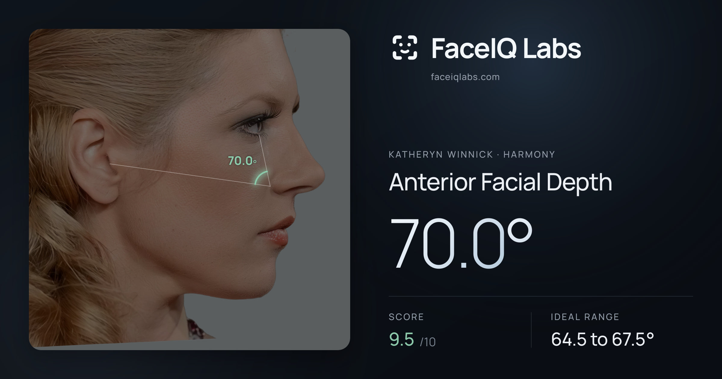 Katheryn Winnick Anterior Facial Depth: 70.0°, drawn on the photo