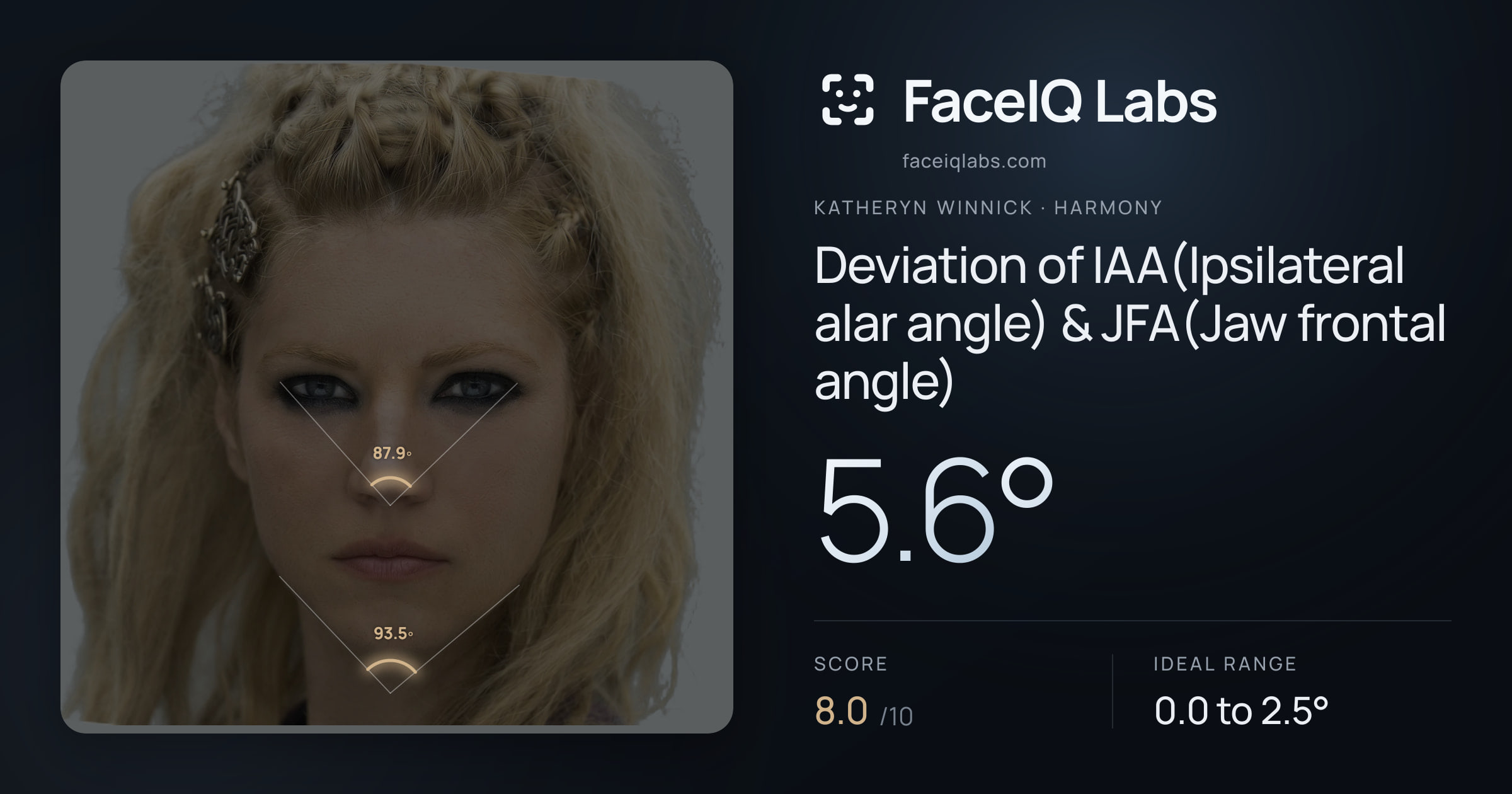 Katheryn Winnick Deviation of IAA(Ipsilateral alar angle) & JFA(Jaw frontal angle): 5.6°, drawn on the photo