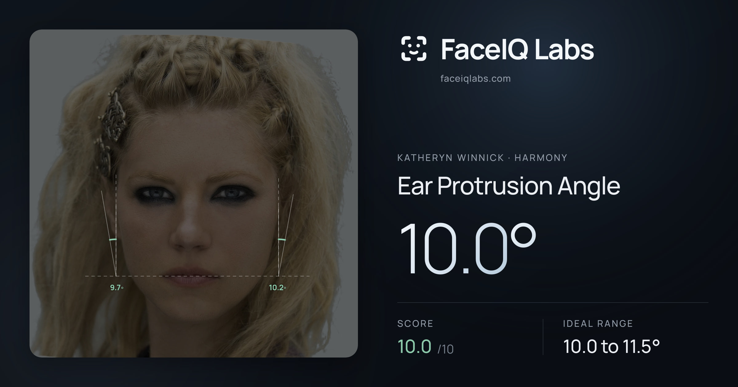 Katheryn Winnick Ear Protrusion Angle: 10.0°, drawn on the photo