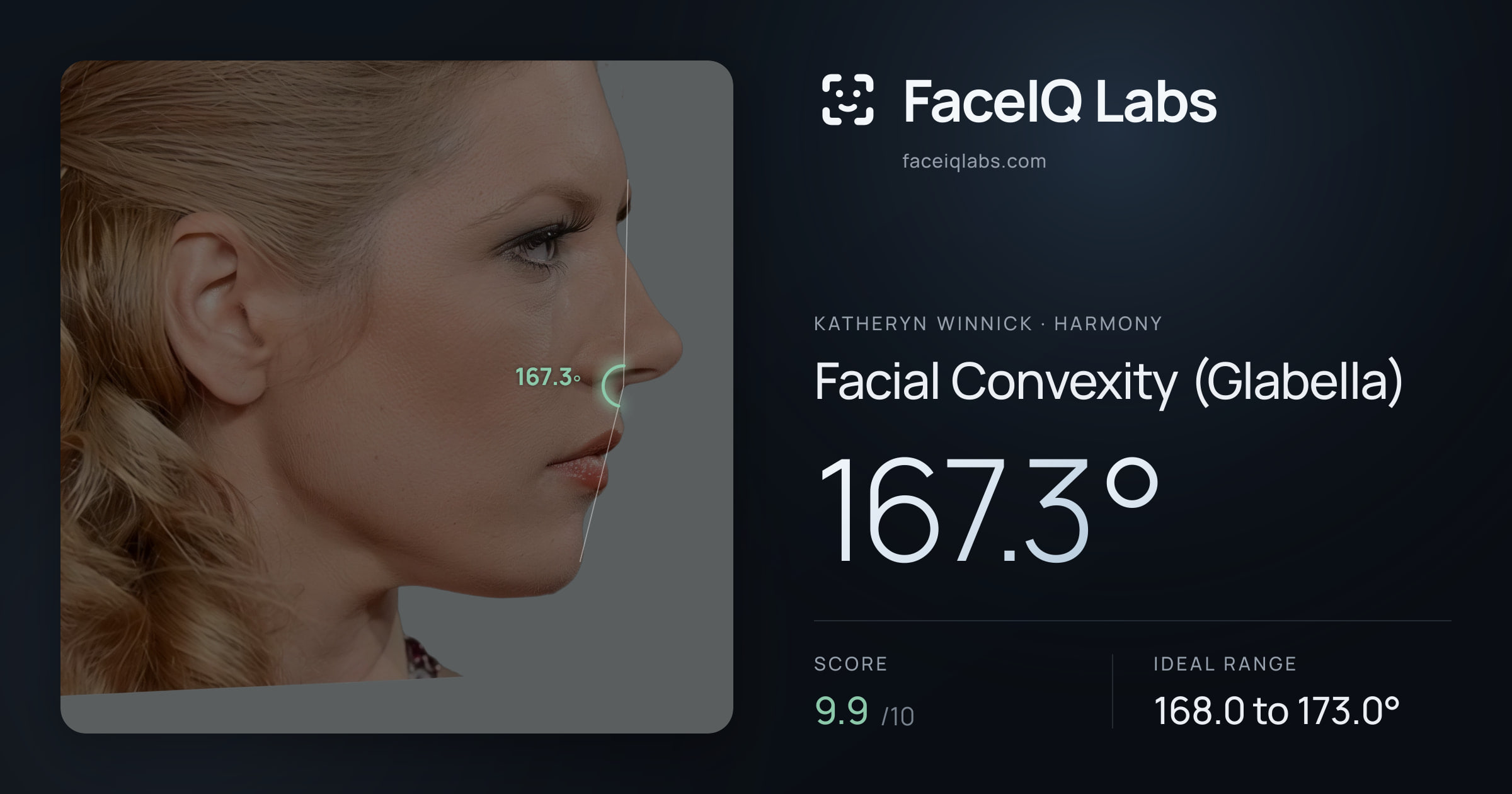 Katheryn Winnick Facial Convexity (Glabella): 167.3°, drawn on the photo