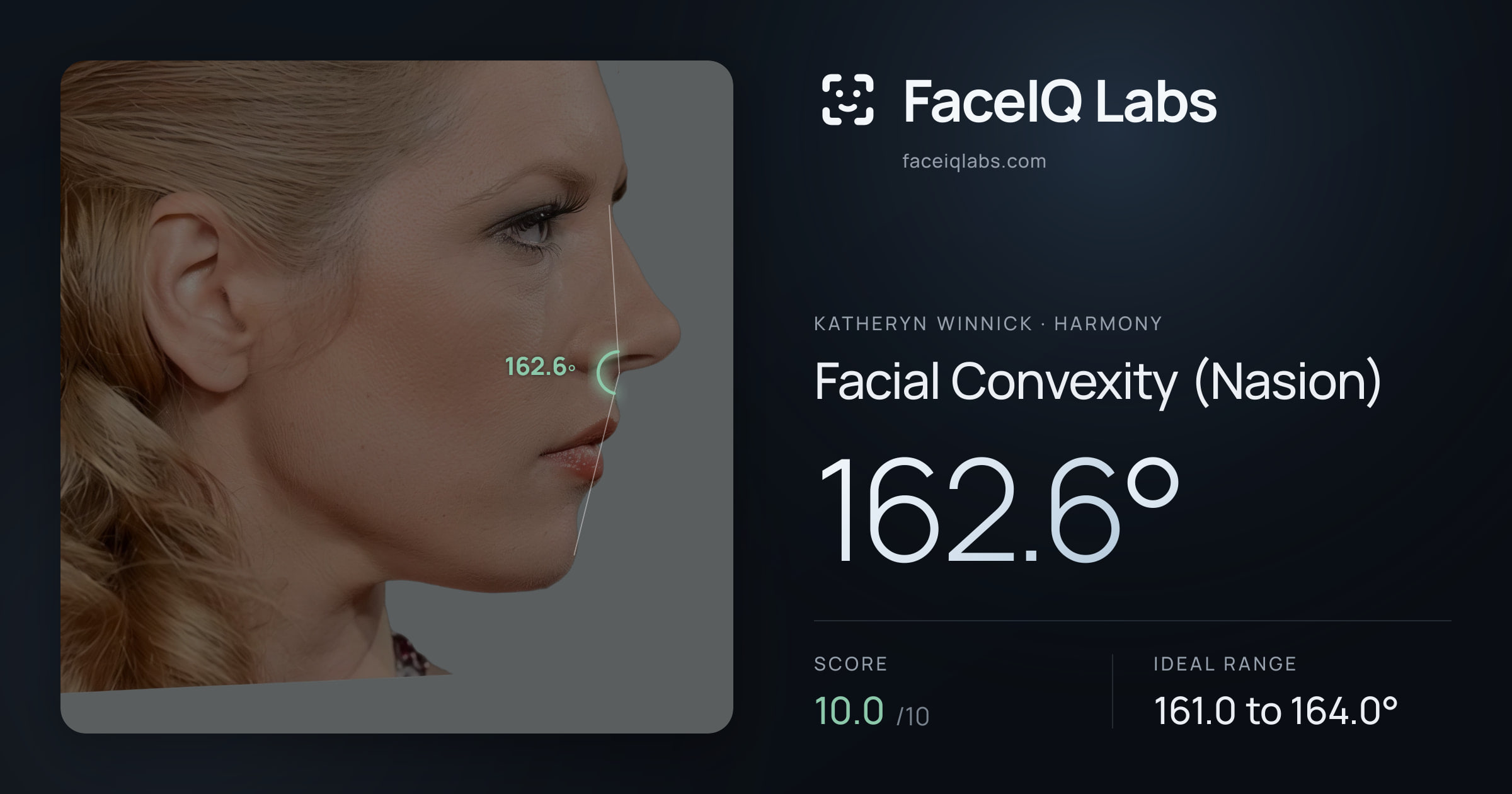 Katheryn Winnick Facial Convexity (Nasion): 162.6°, drawn on the photo