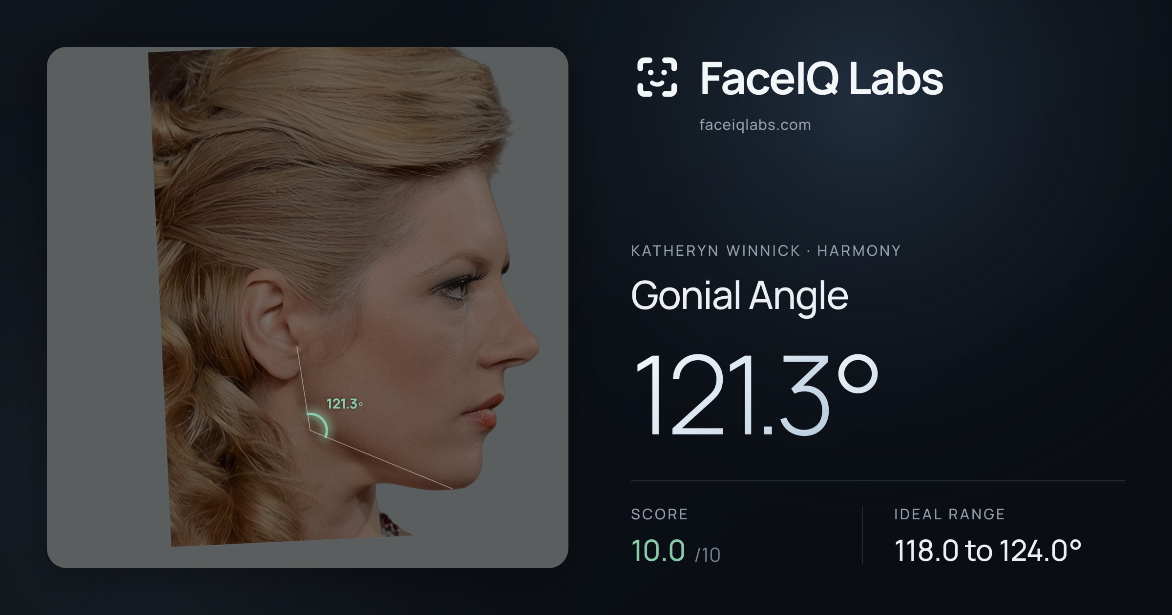 Katheryn Winnick Gonial Angle: 121.3°, drawn on the photo