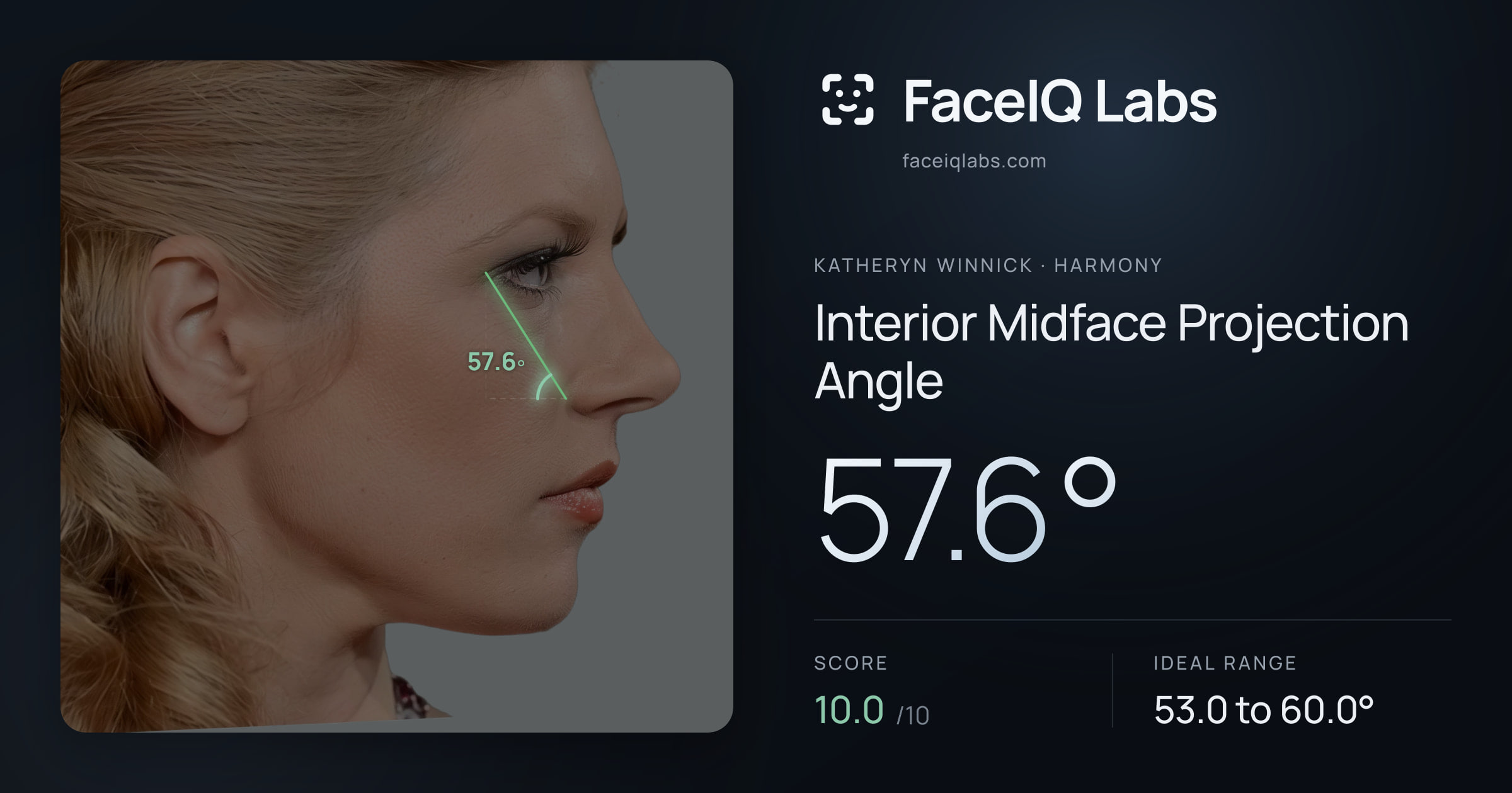 Katheryn Winnick Interior Midface Projection Angle: 57.6°, drawn on the photo