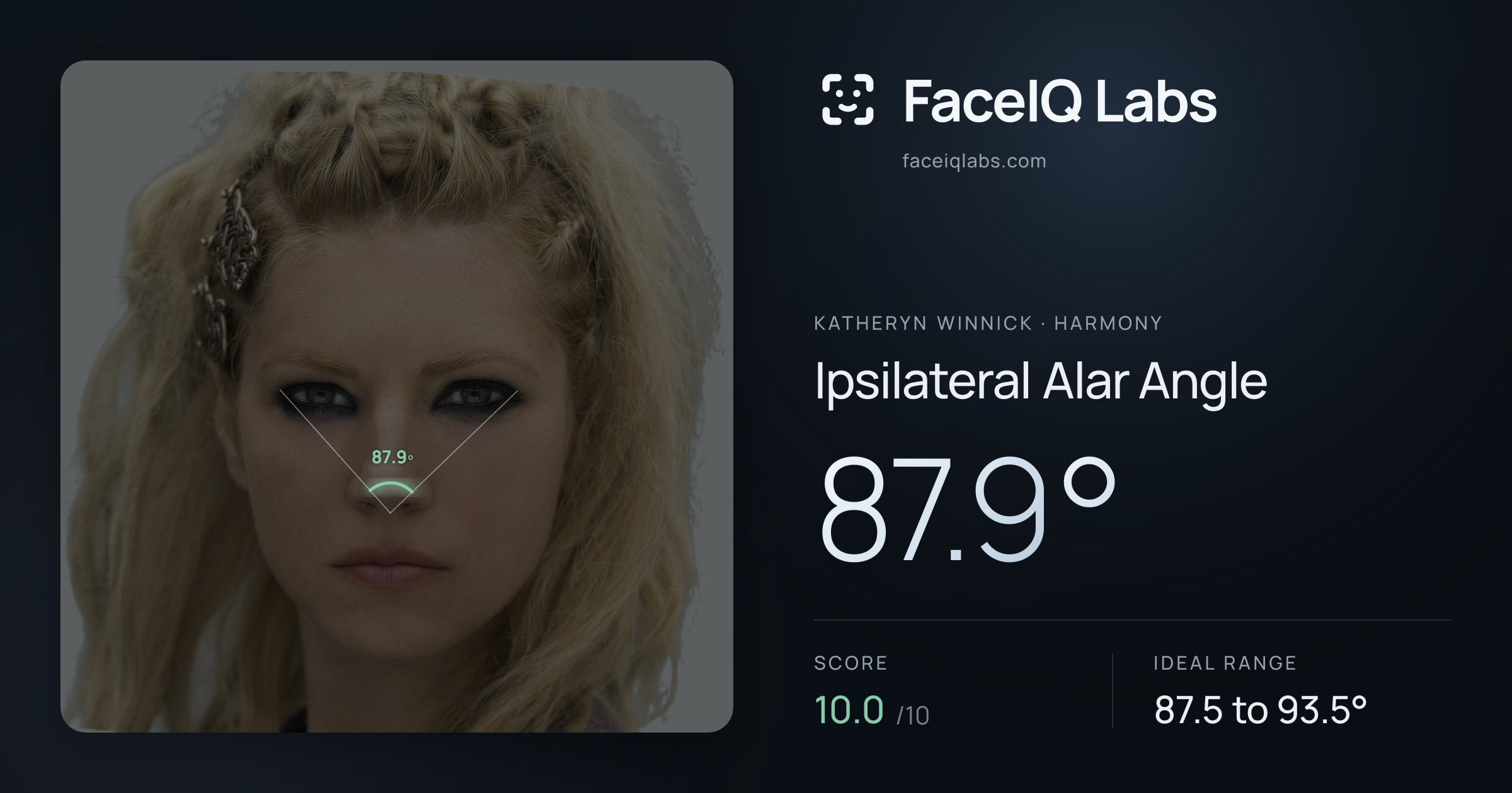 Katheryn Winnick Ipsilateral Alar Angle: 87.9°, drawn on the photo
