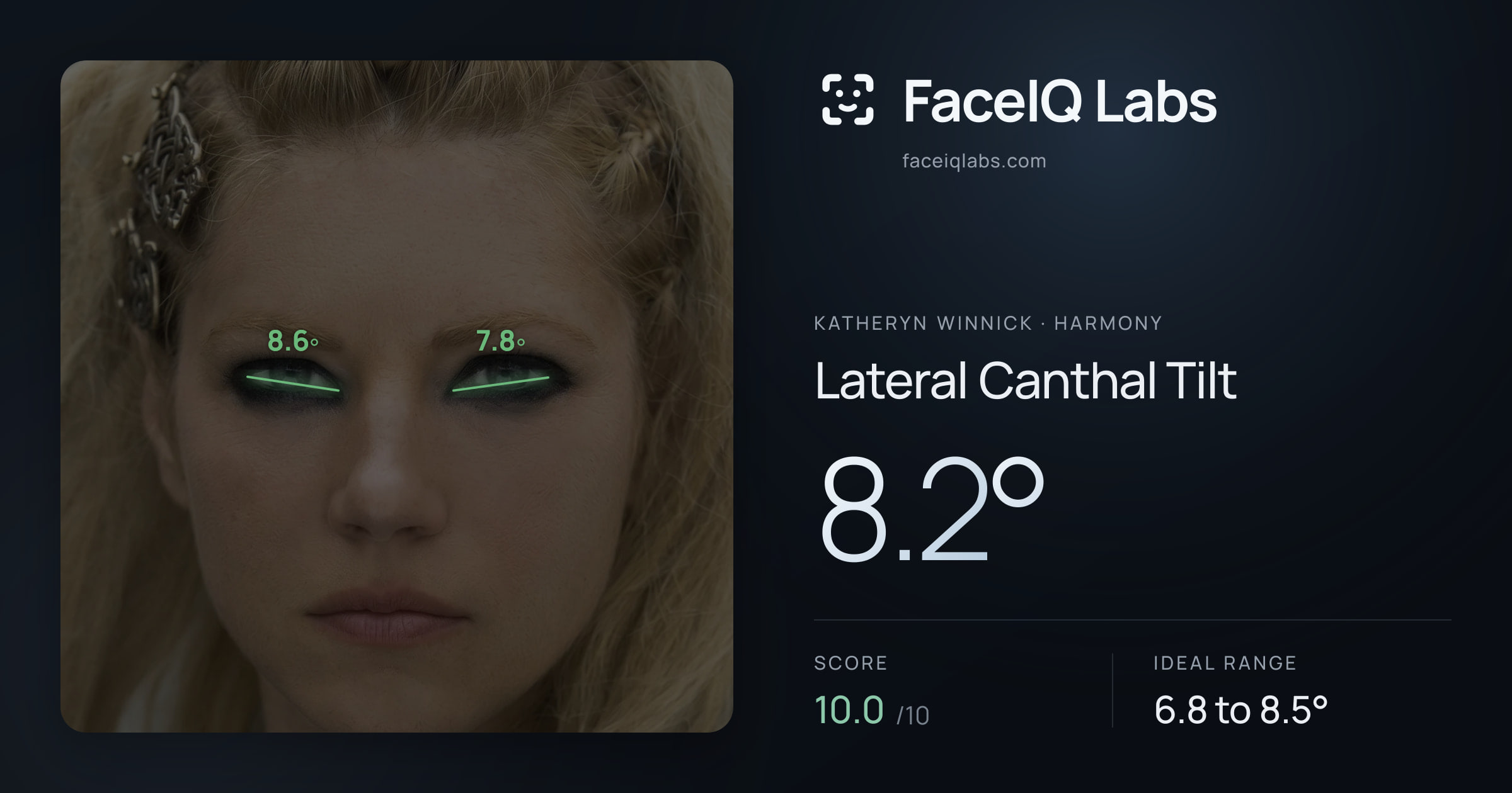 Katheryn Winnick Lateral Canthal Tilt: 8.2°, drawn on the photo