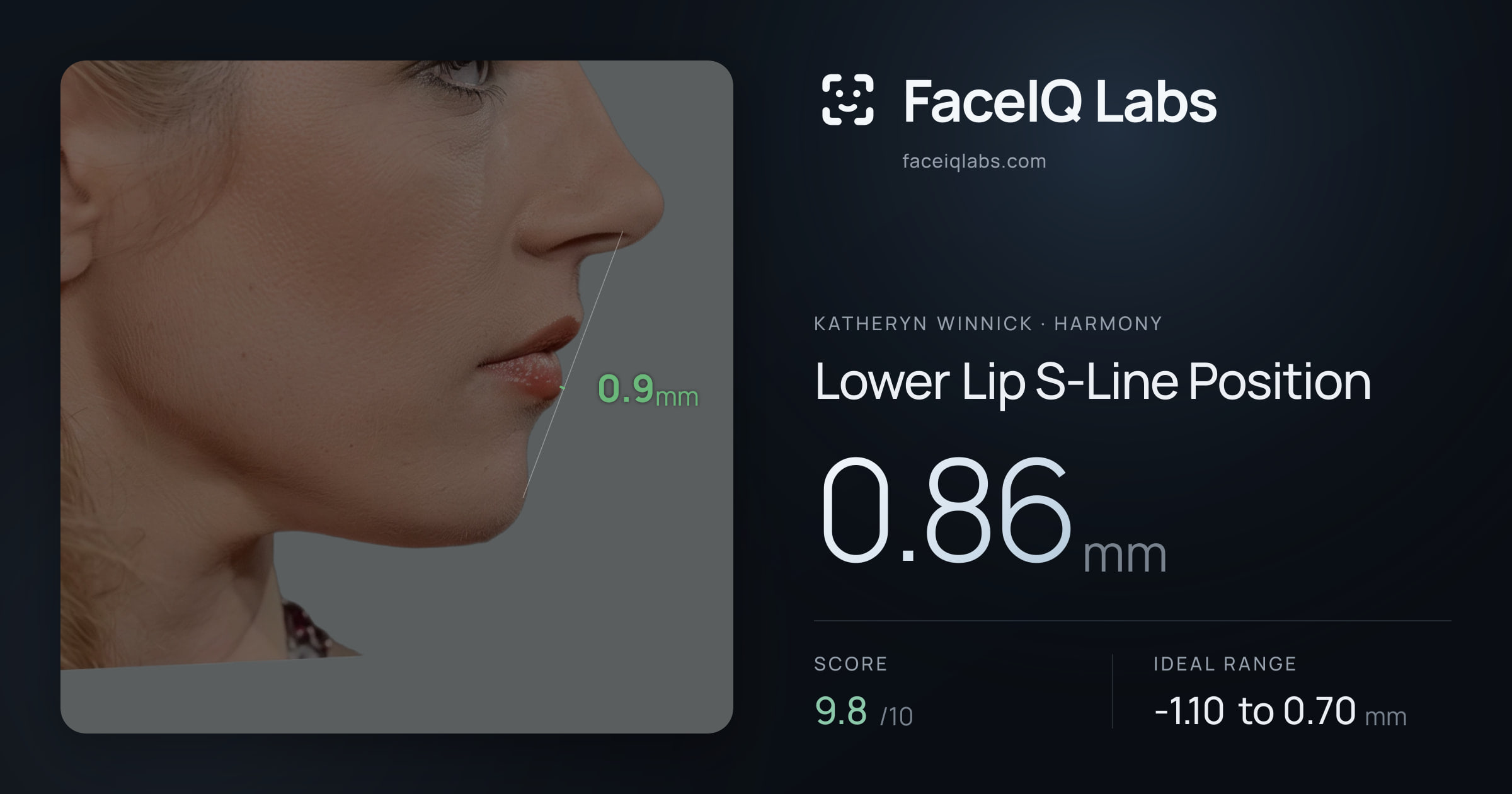 Katheryn Winnick Lower Lip S-Line Position: 0.86mm, drawn on the photo