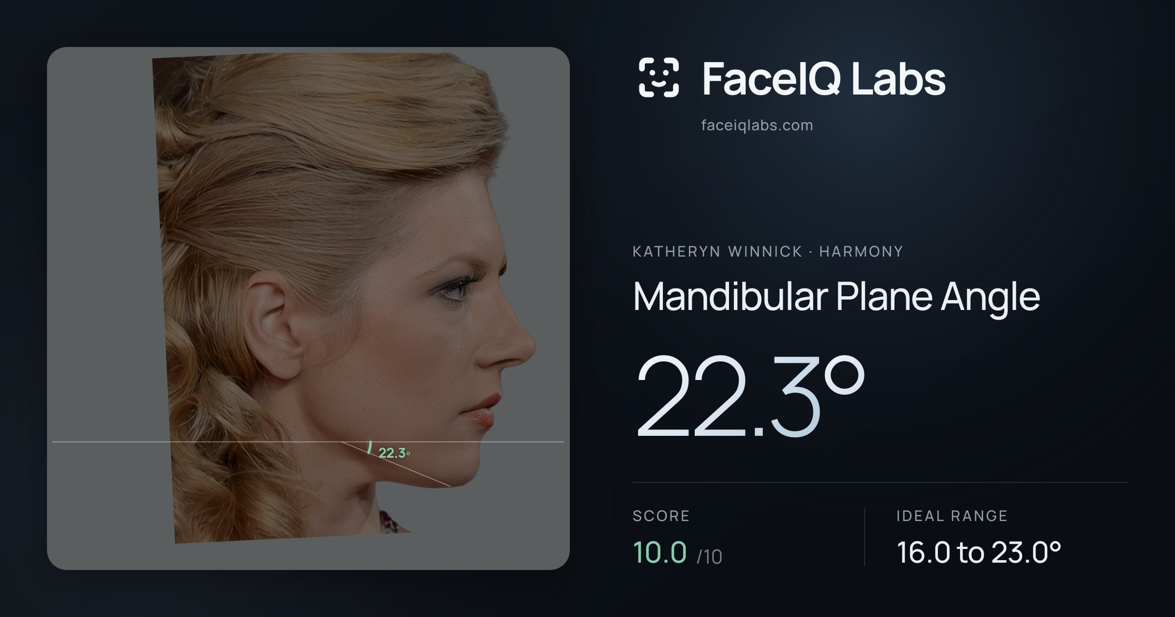Katheryn Winnick Mandibular Plane Angle: 22.3°, drawn on the photo