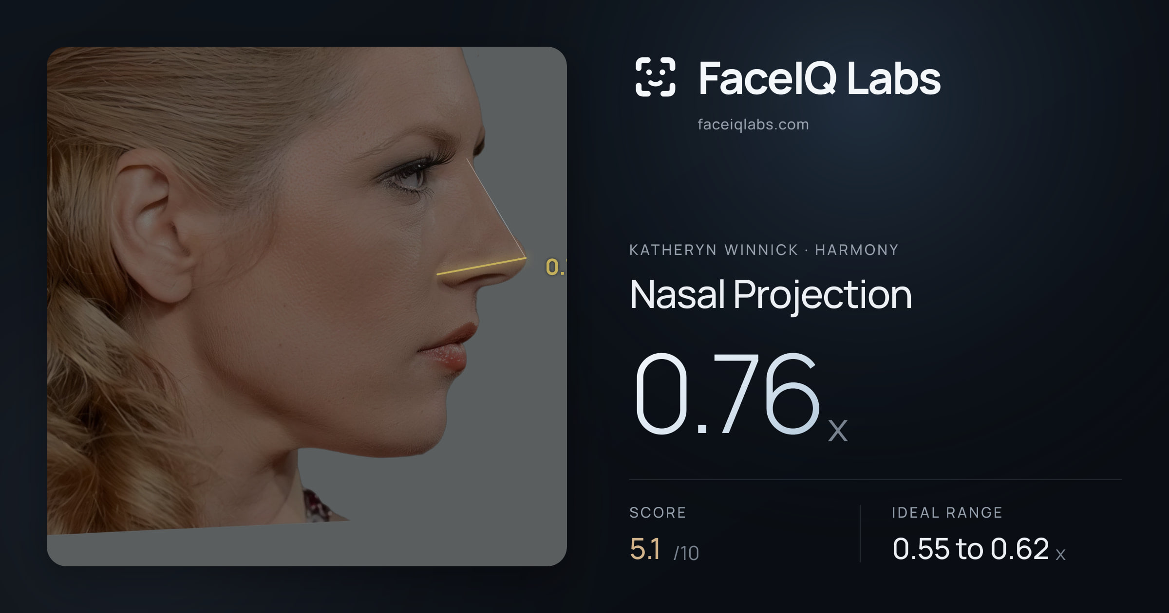 Katheryn Winnick Nasal Projection: 0.76x, drawn on the photo