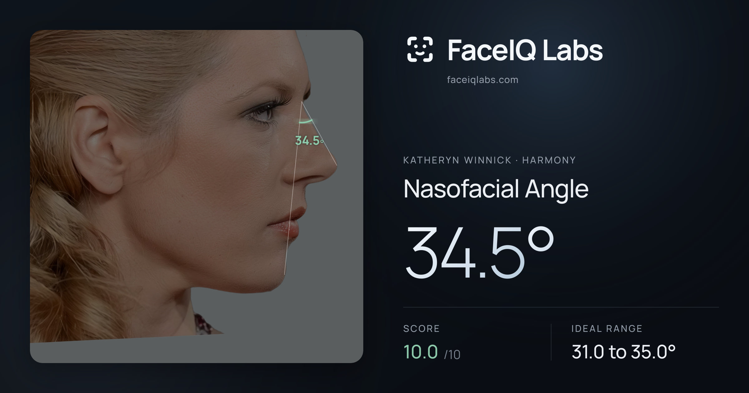 Katheryn Winnick Nasofacial Angle: 34.5°, drawn on the photo