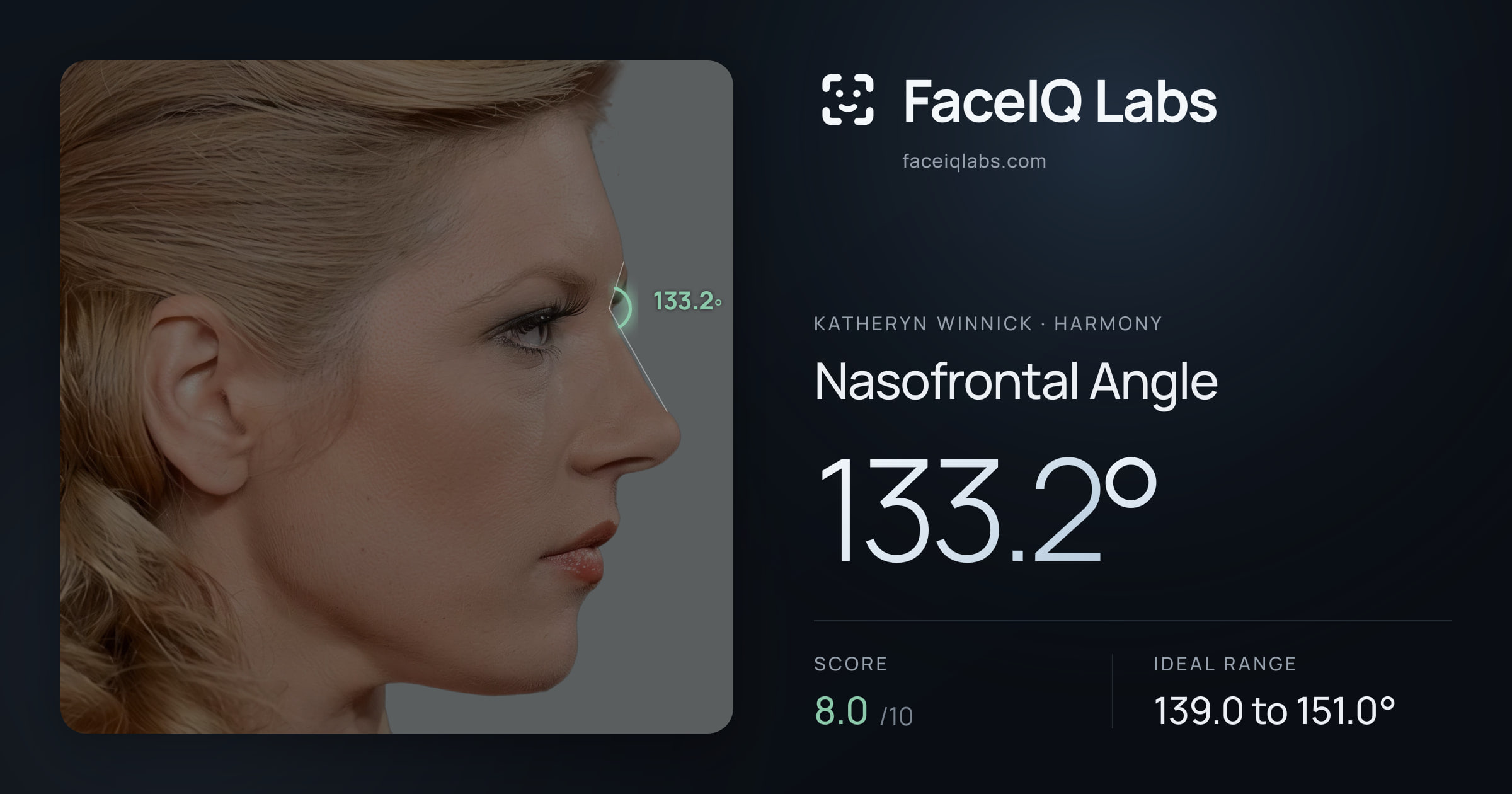 Katheryn Winnick Nasofrontal Angle: 133.2°, drawn on the photo