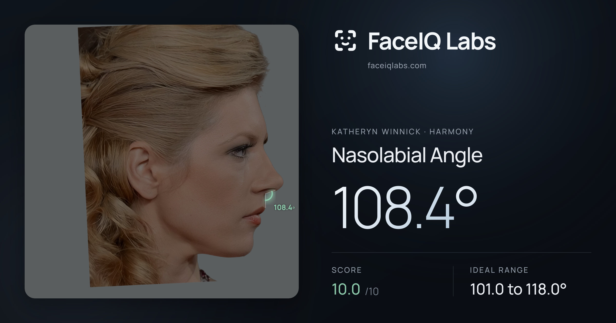 Katheryn Winnick Nasolabial Angle: 108.4°, drawn on the photo