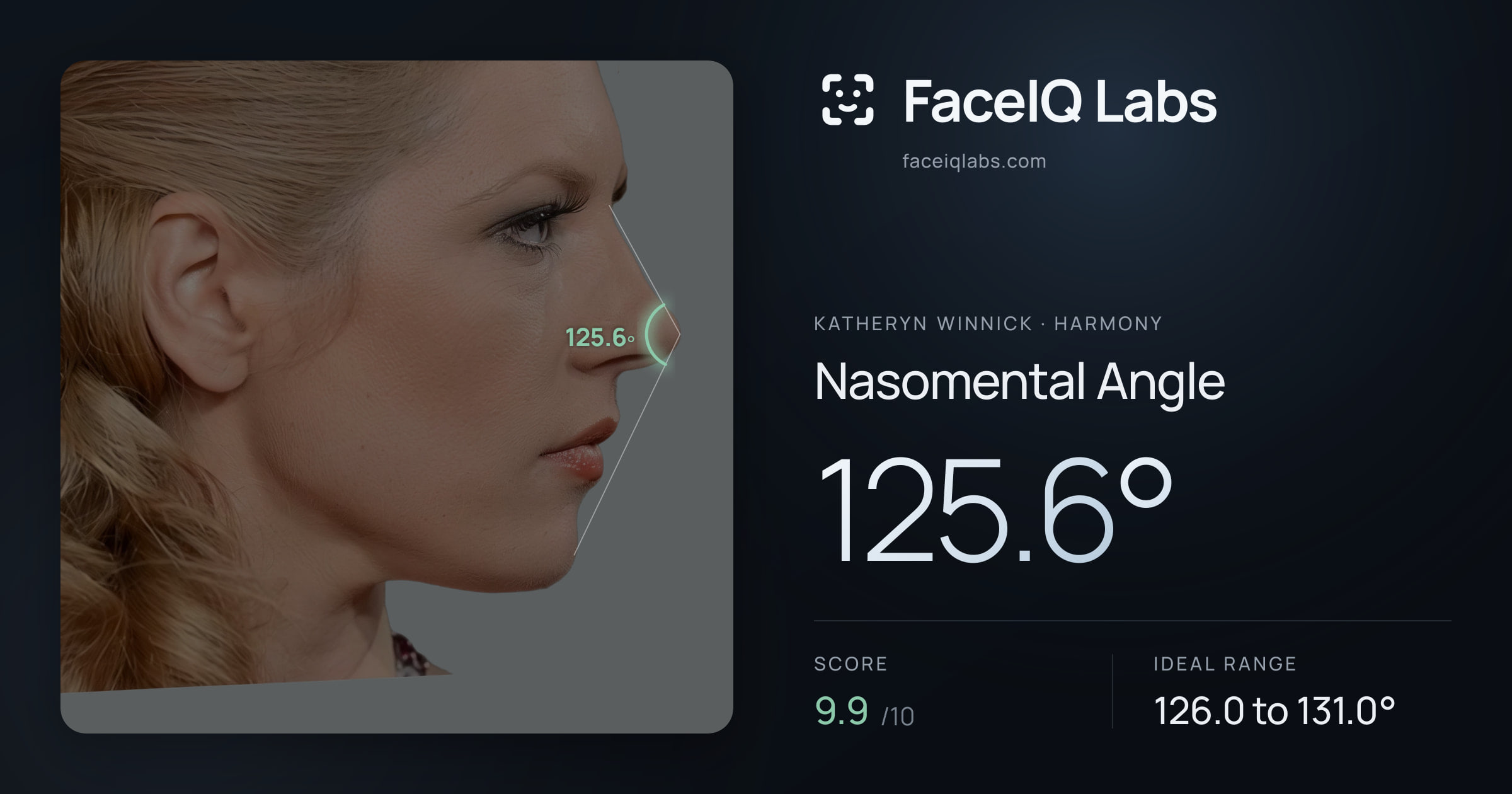 Katheryn Winnick Nasomental Angle: 125.6°, drawn on the photo