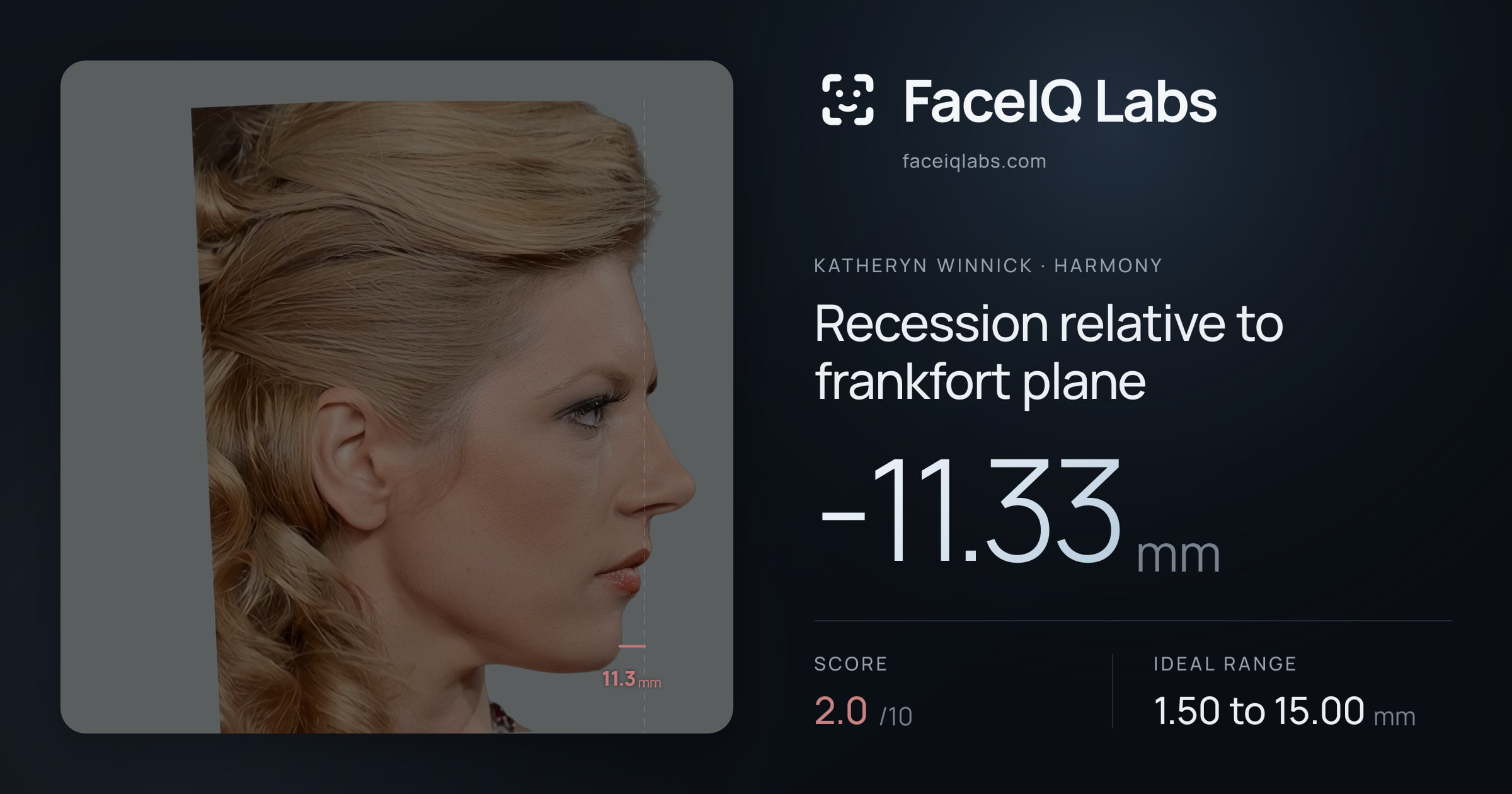 Katheryn Winnick Recession relative to frankfort plane: -11.33mm, drawn on the photo