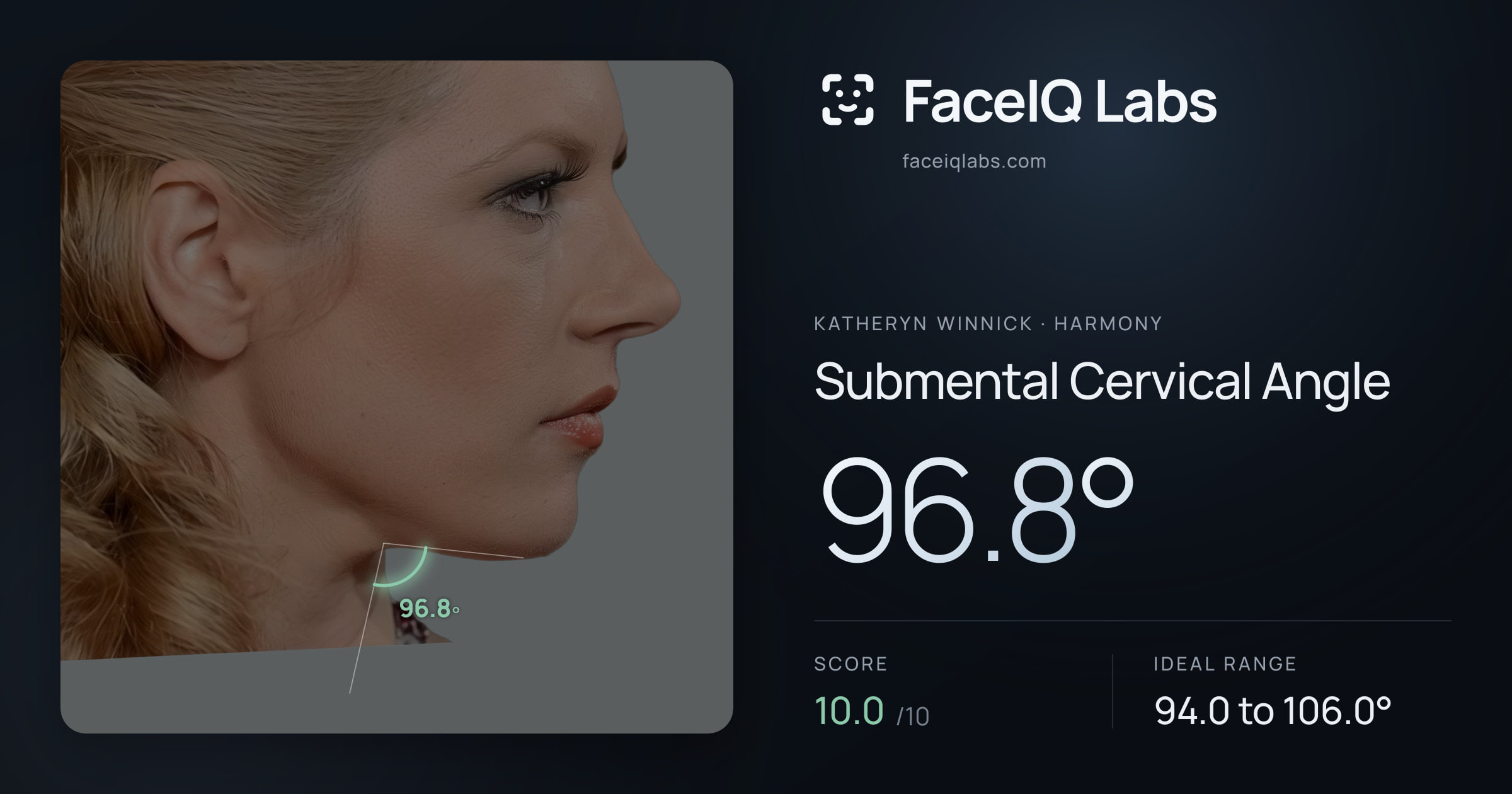 Katheryn Winnick Submental Cervical Angle: 96.8°, drawn on the photo
