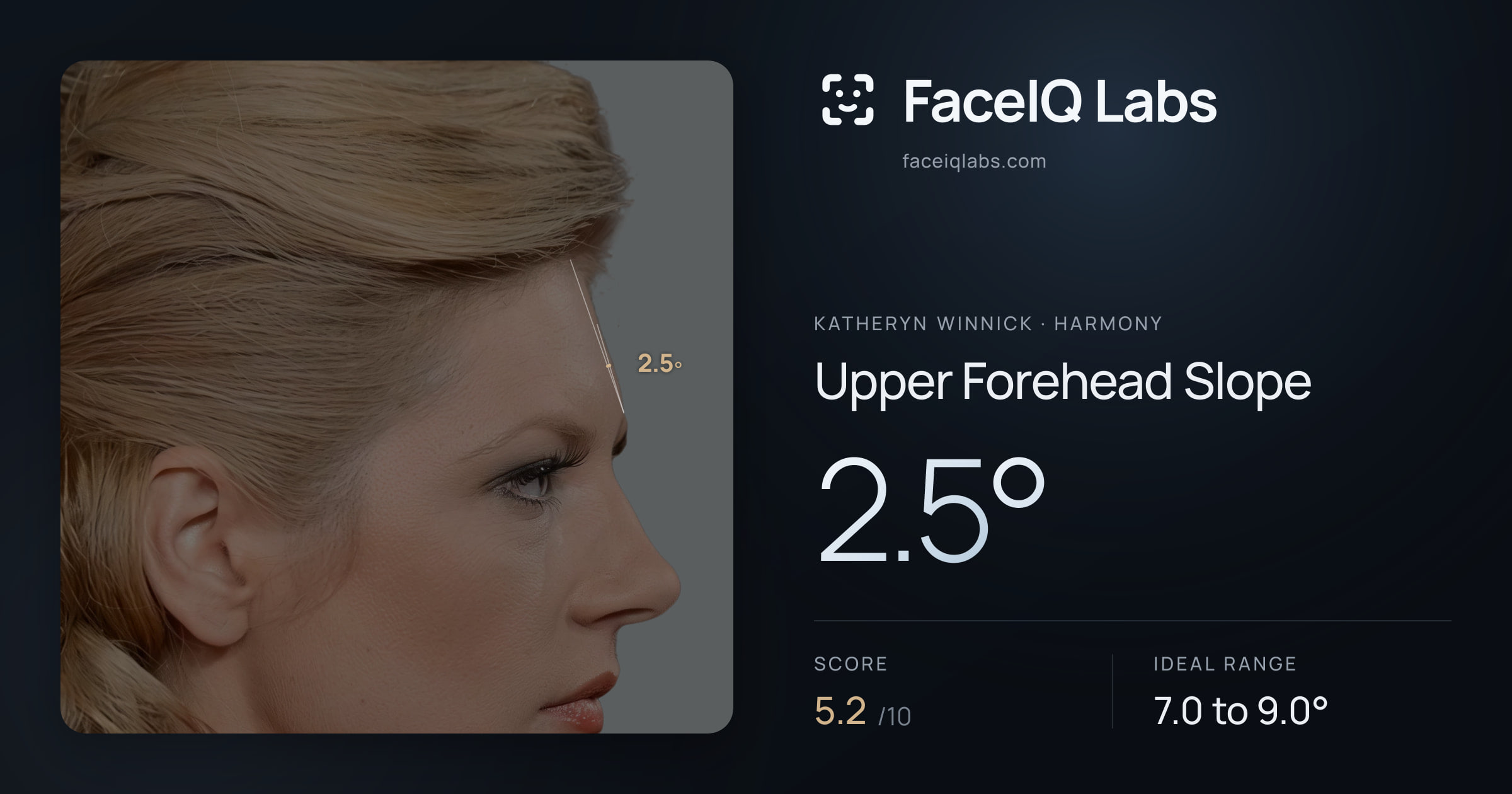 Katheryn Winnick Upper Forehead Slope: 2.5°, drawn on the photo