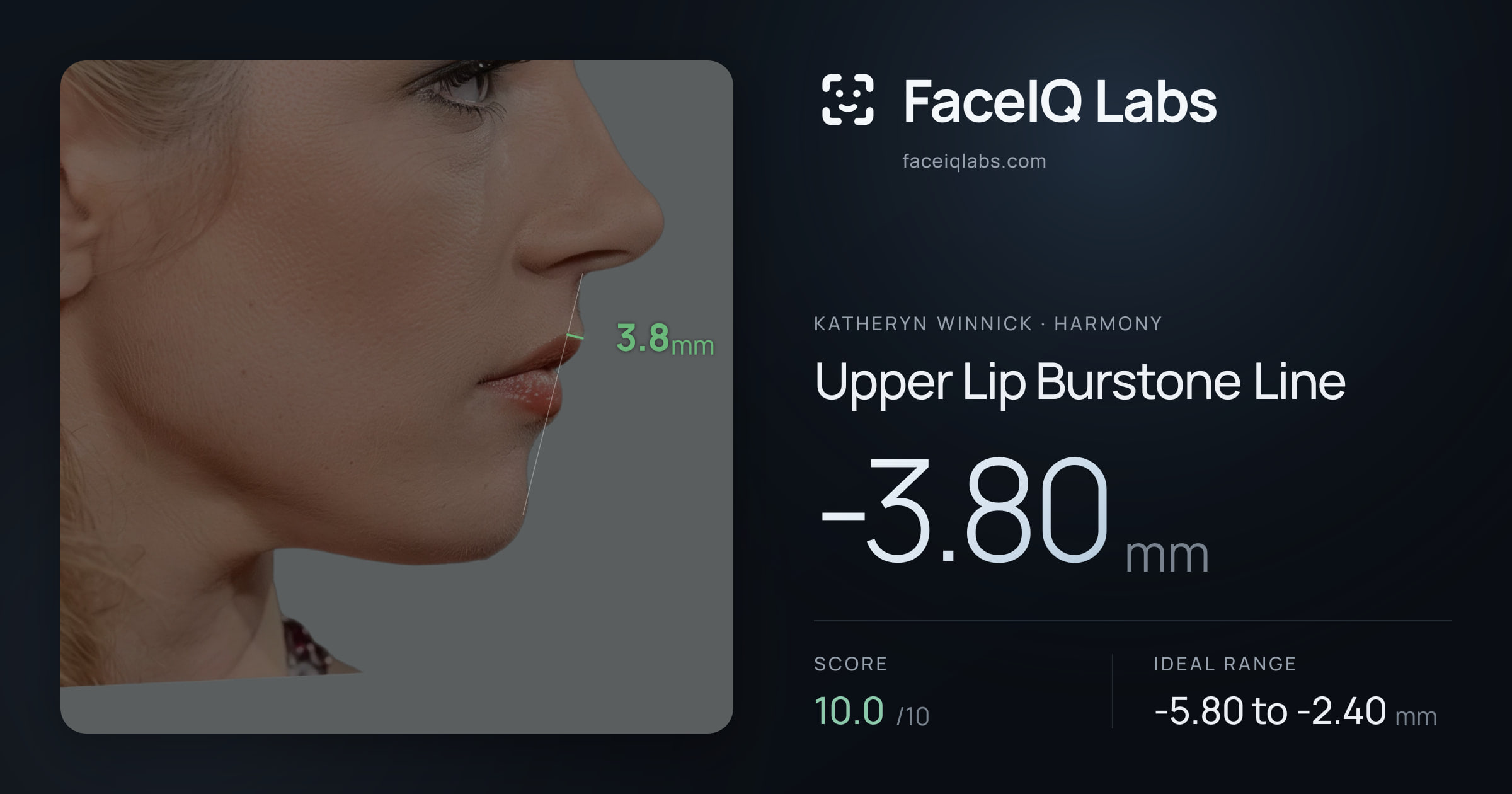 Katheryn Winnick Upper Lip Burstone Line: -3.80mm, drawn on the photo
