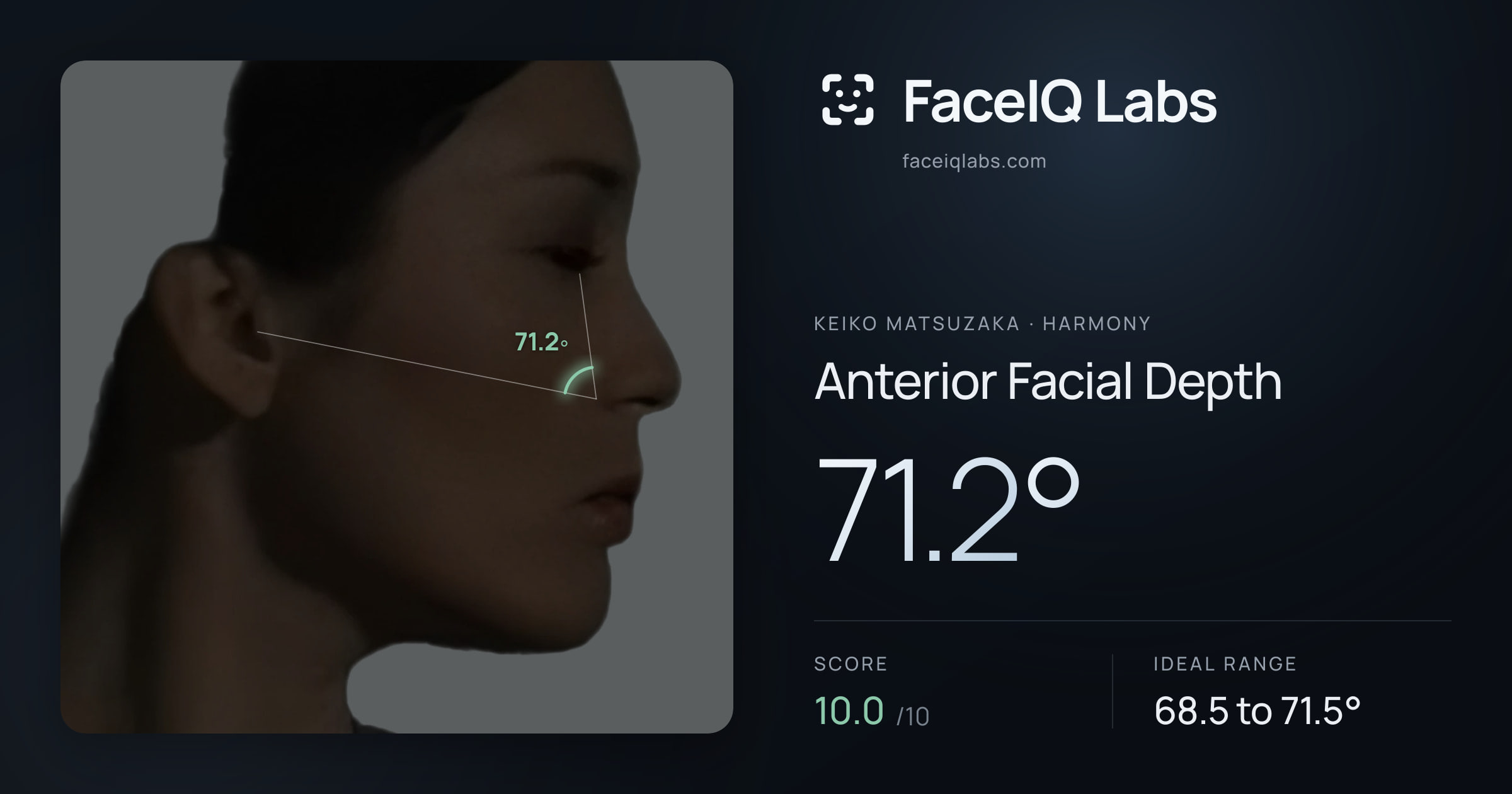 Keiko Matsuzaka Anterior Facial Depth: 71.2°, drawn on the photo