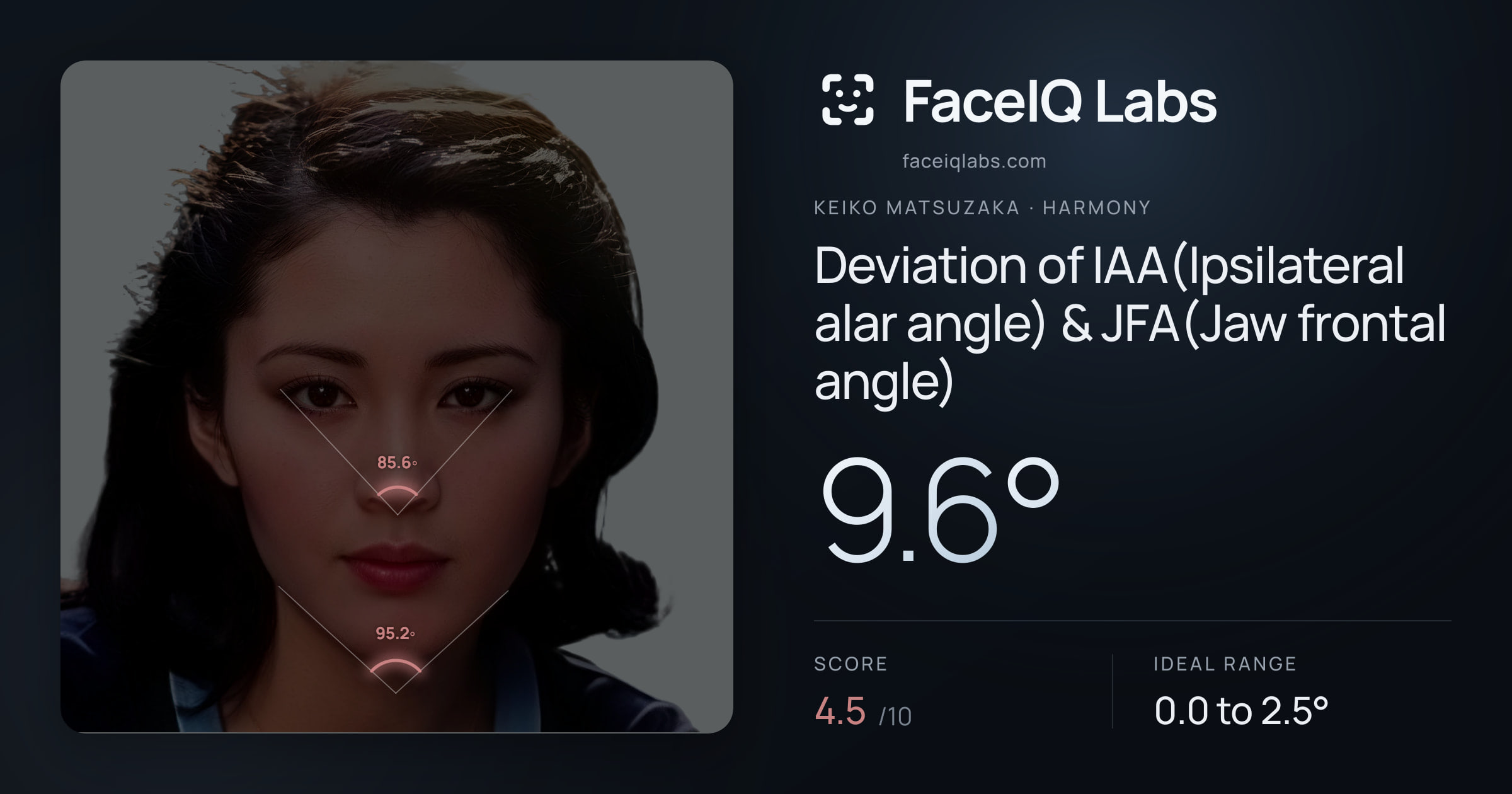 Keiko Matsuzaka Deviation of IAA(Ipsilateral alar angle) & JFA(Jaw frontal angle): 9.6°, drawn on the photo