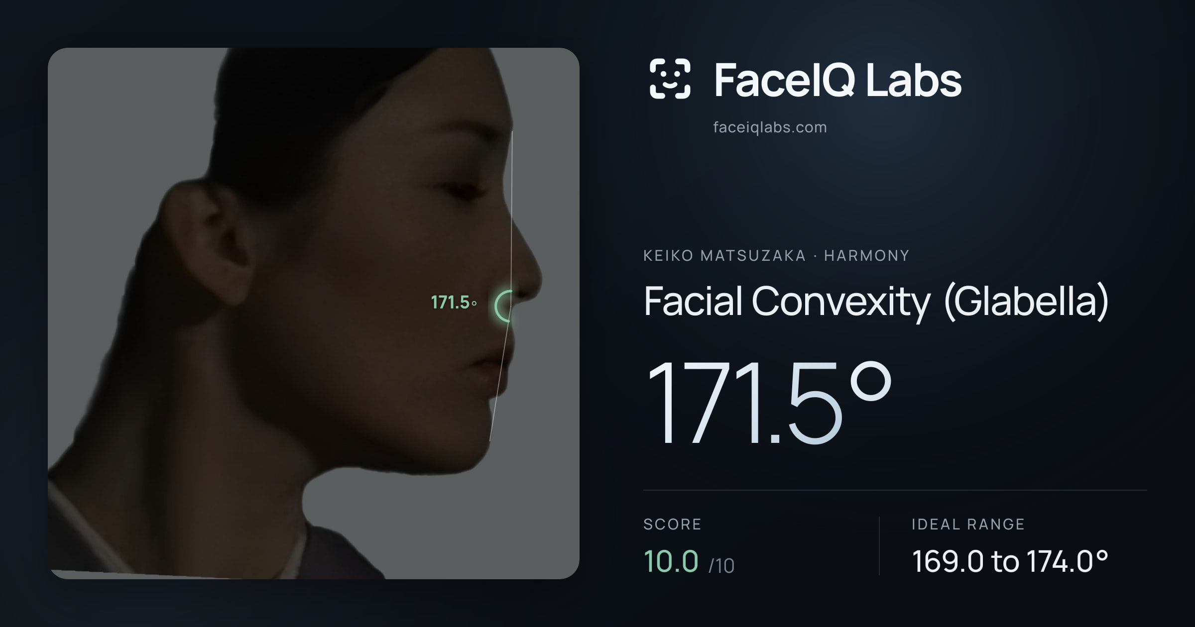 Keiko Matsuzaka Facial Convexity (Glabella): 171.5°, drawn on the photo