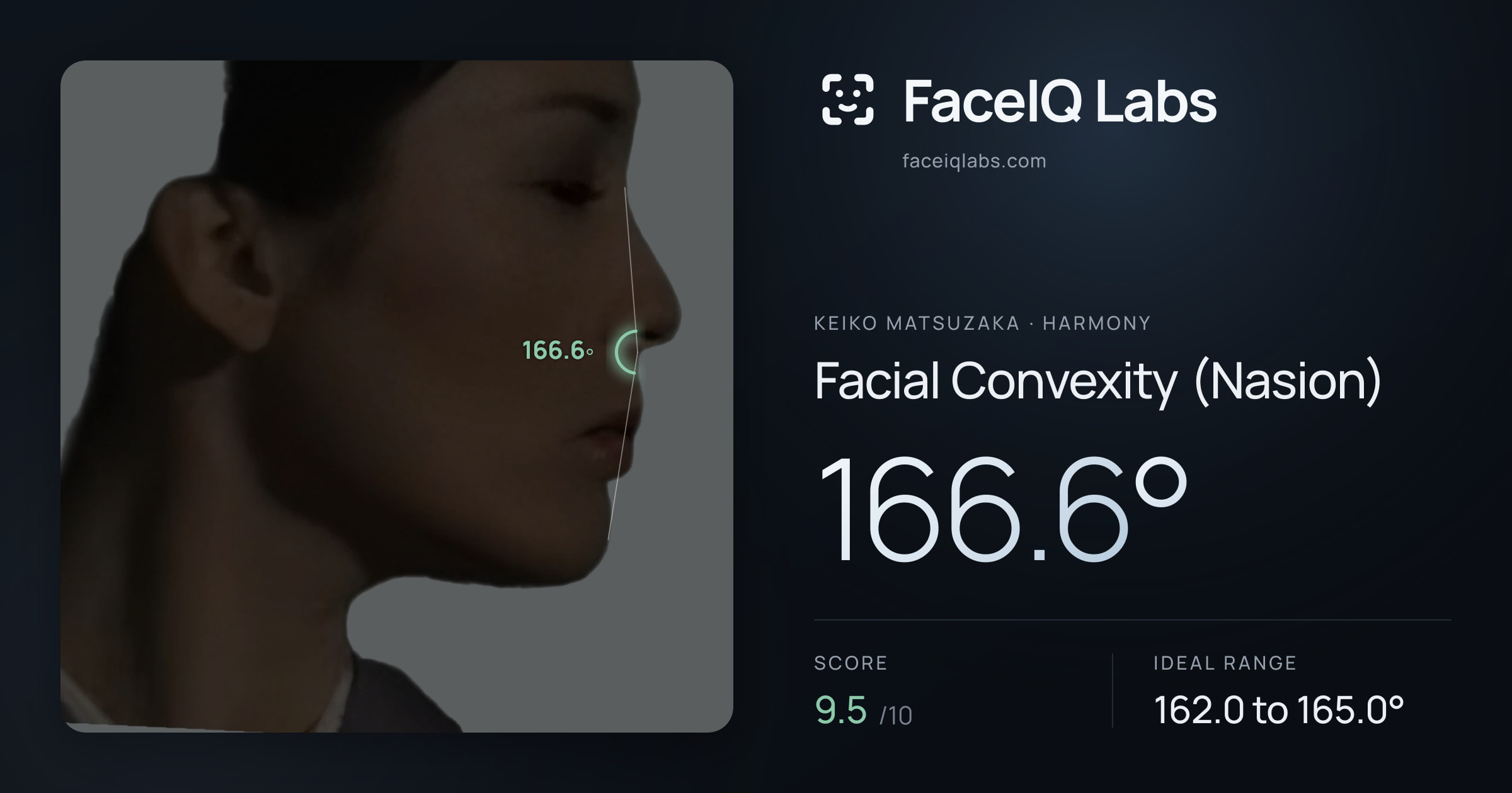 Keiko Matsuzaka Facial Convexity (Nasion): 166.6°, drawn on the photo