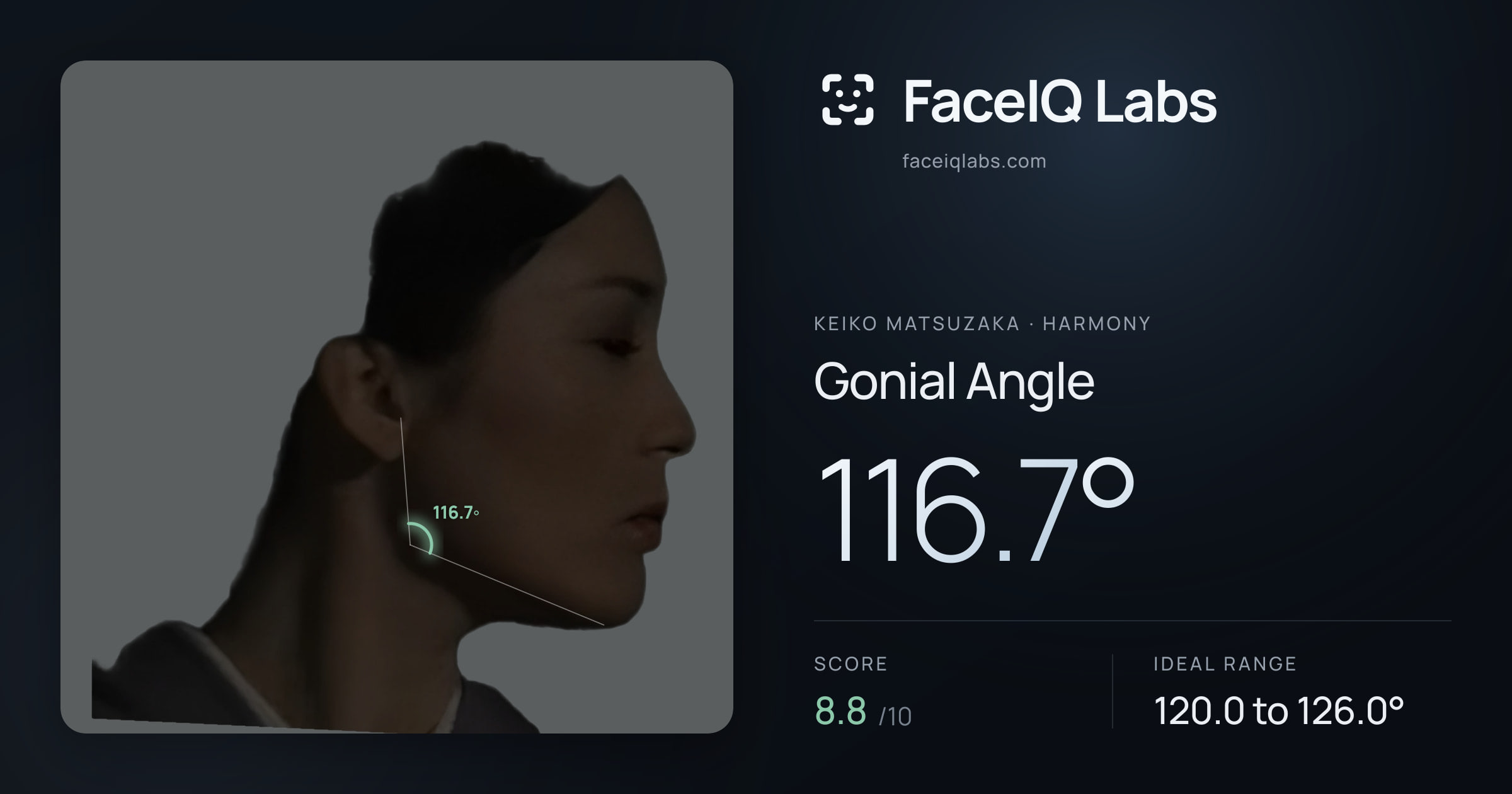 Keiko Matsuzaka Gonial Angle: 116.7°, drawn on the photo