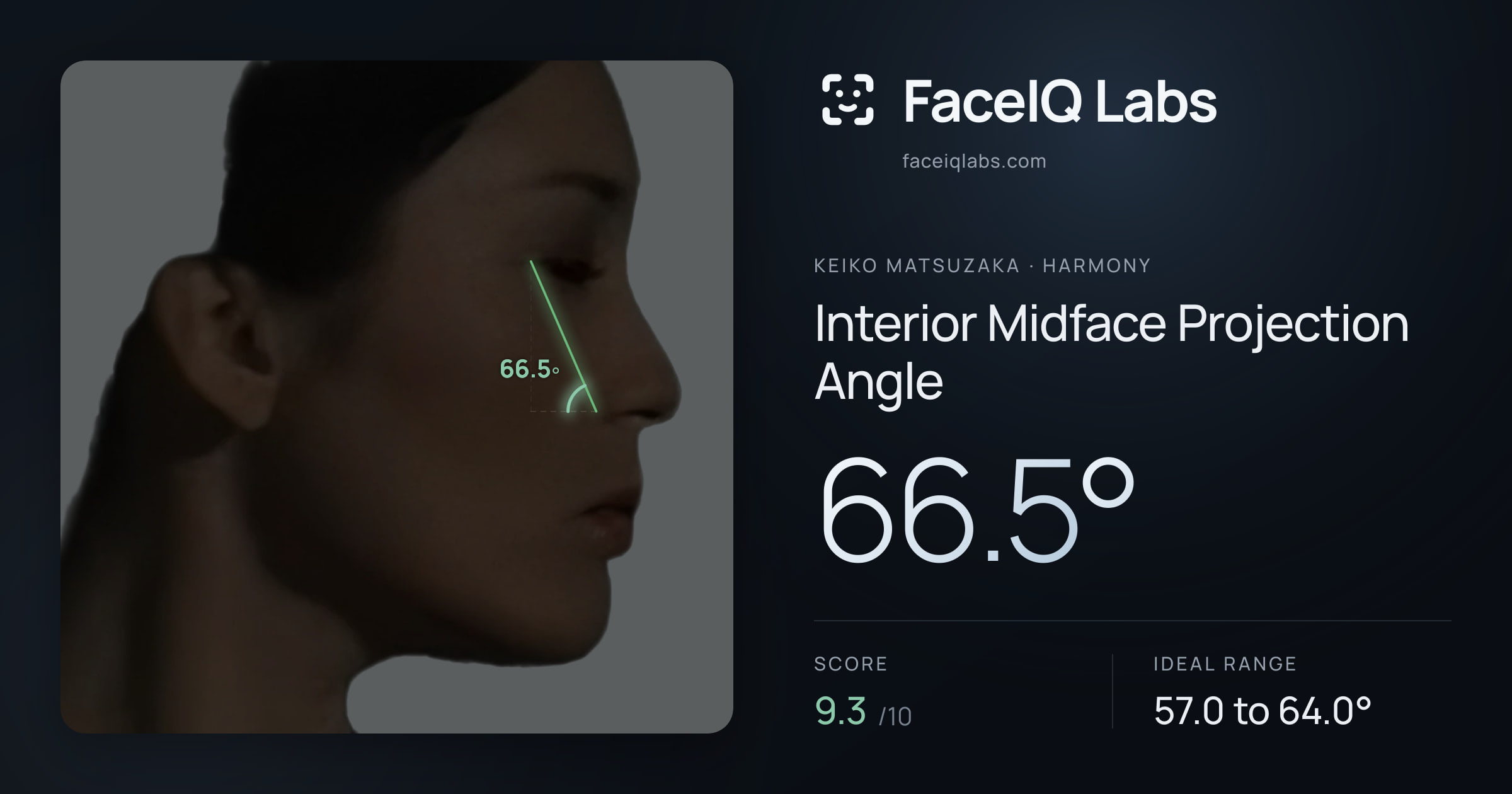 Keiko Matsuzaka Interior Midface Projection Angle: 66.5°, drawn on the photo
