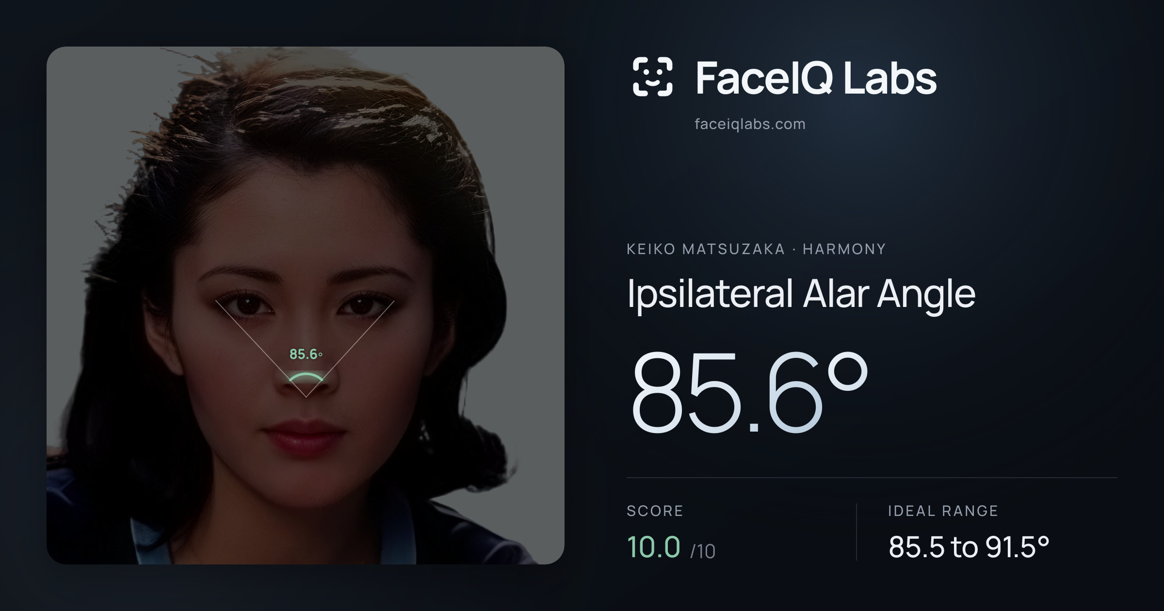 Keiko Matsuzaka Ipsilateral Alar Angle: 85.6°, drawn on the photo