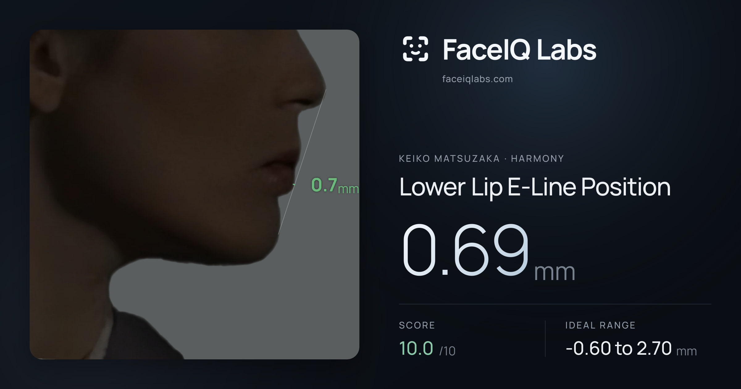 Keiko Matsuzaka Lower Lip E-Line Position: 0.69mm, drawn on the photo